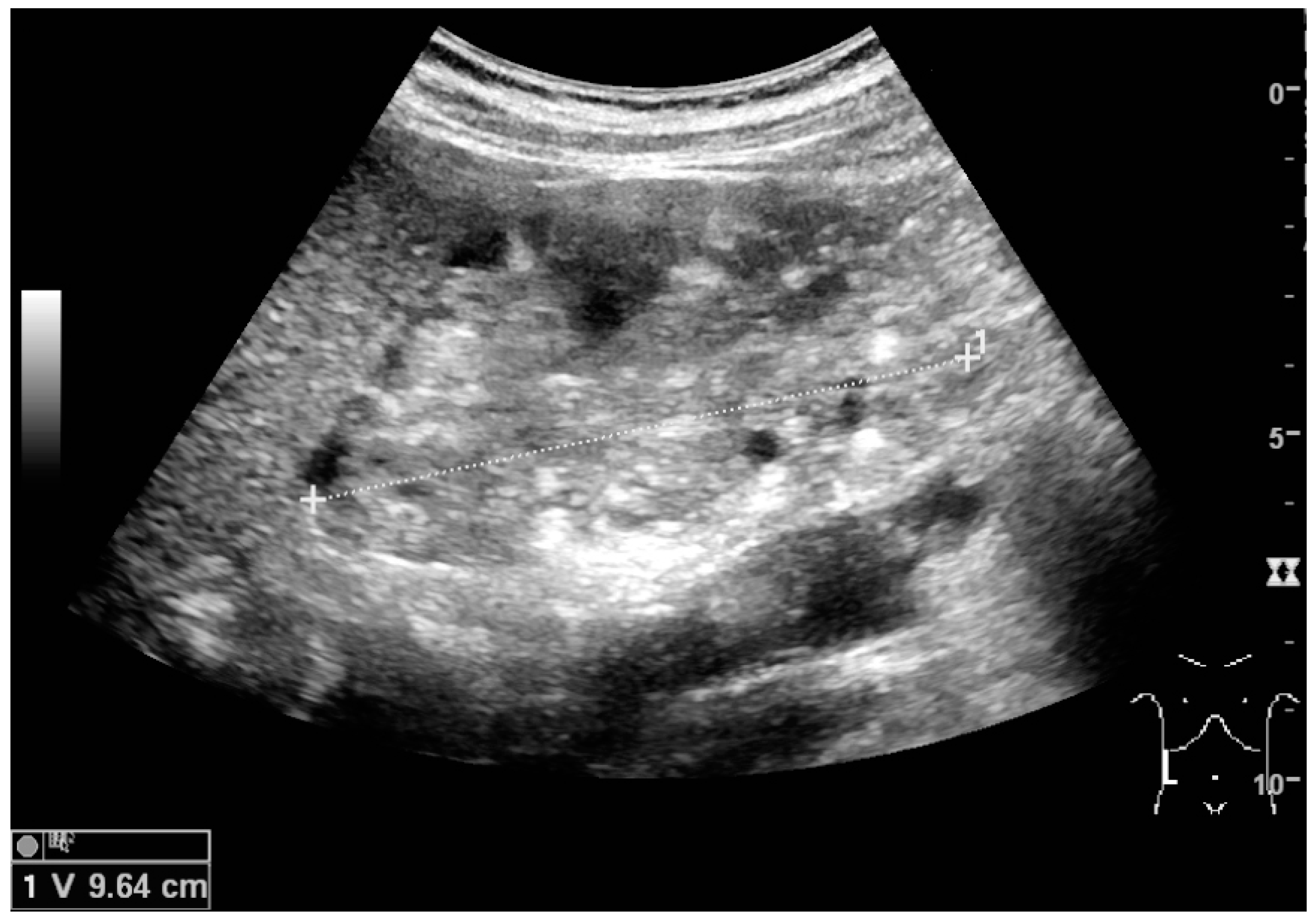 世界的に有名な Renal of Atlas Ultrasonography 腎臓 希少 参考書