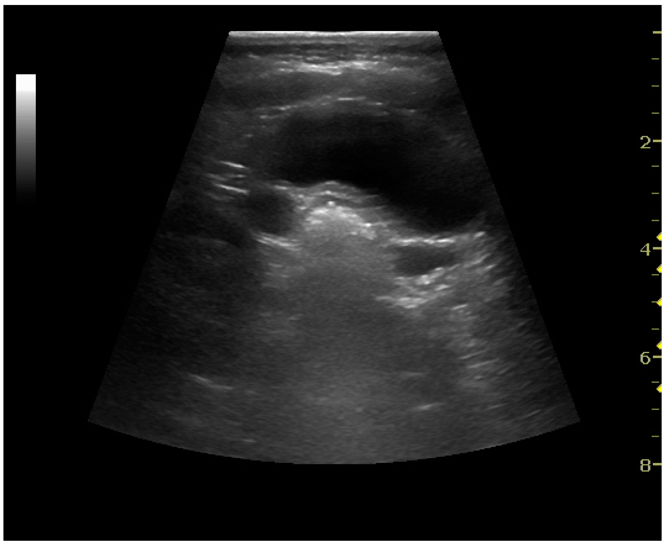 Diagnostics 06 00002 g014 1024