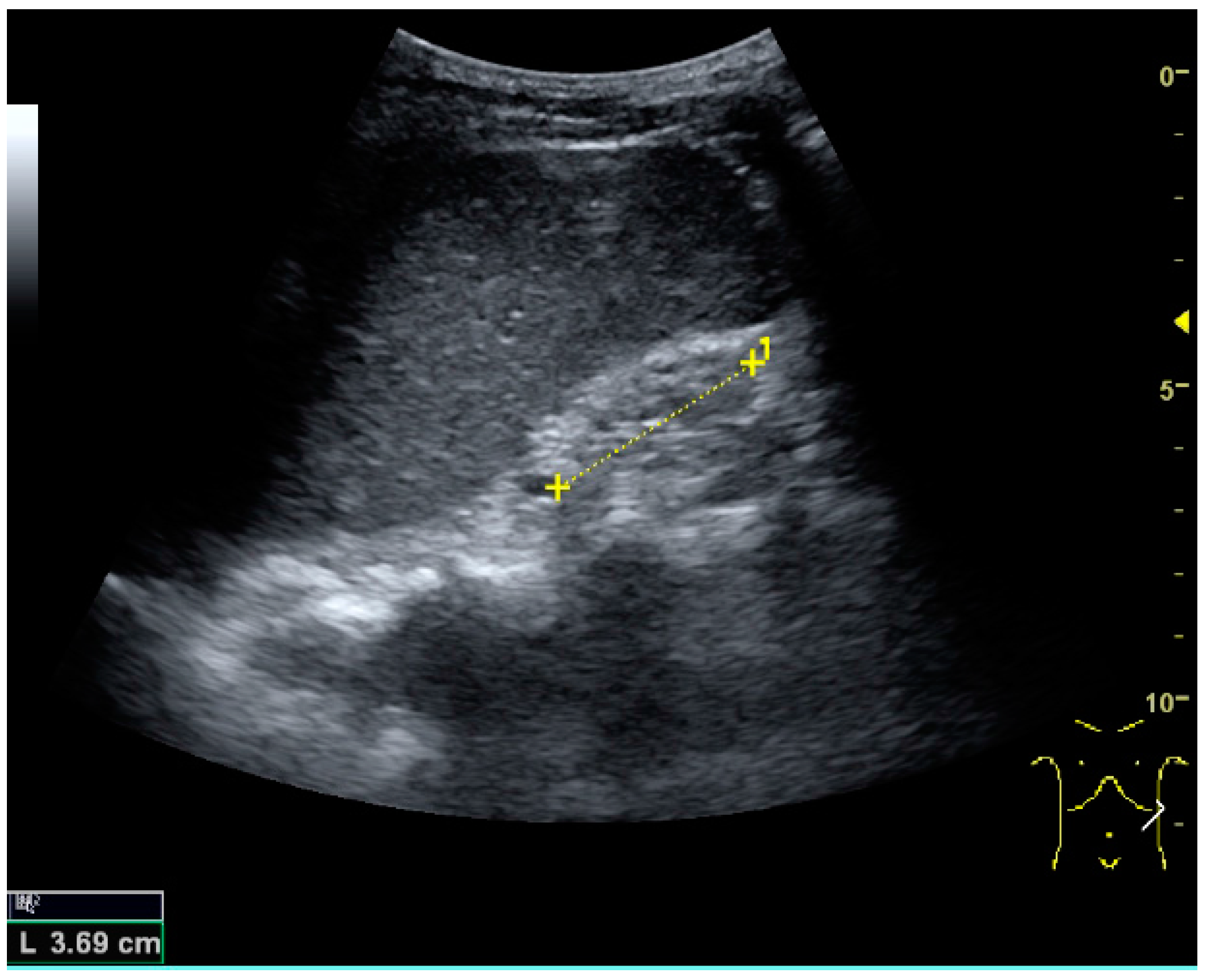 Diagnostics 06 00002 g025 1024