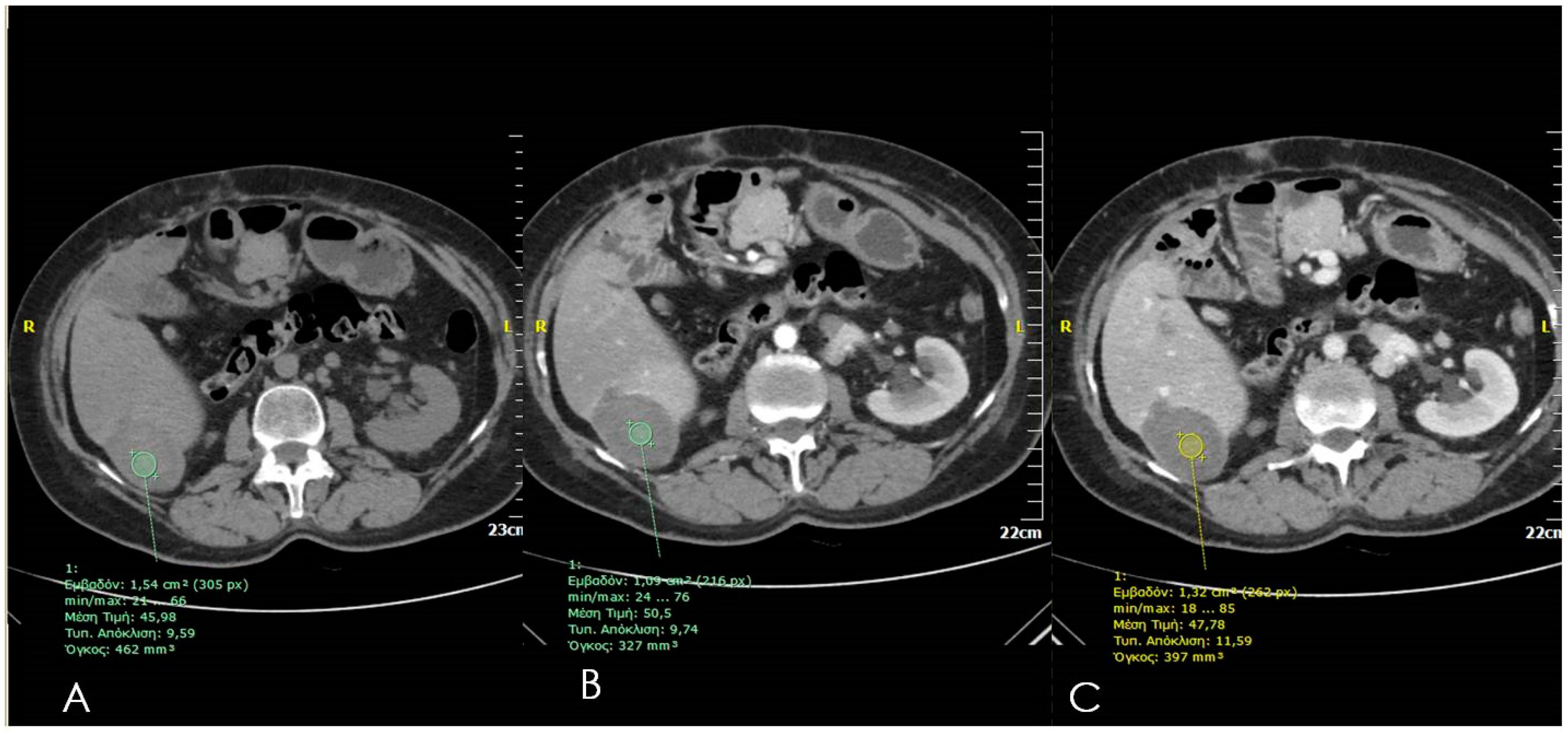Diagnostics 06 00009 g003 1024
