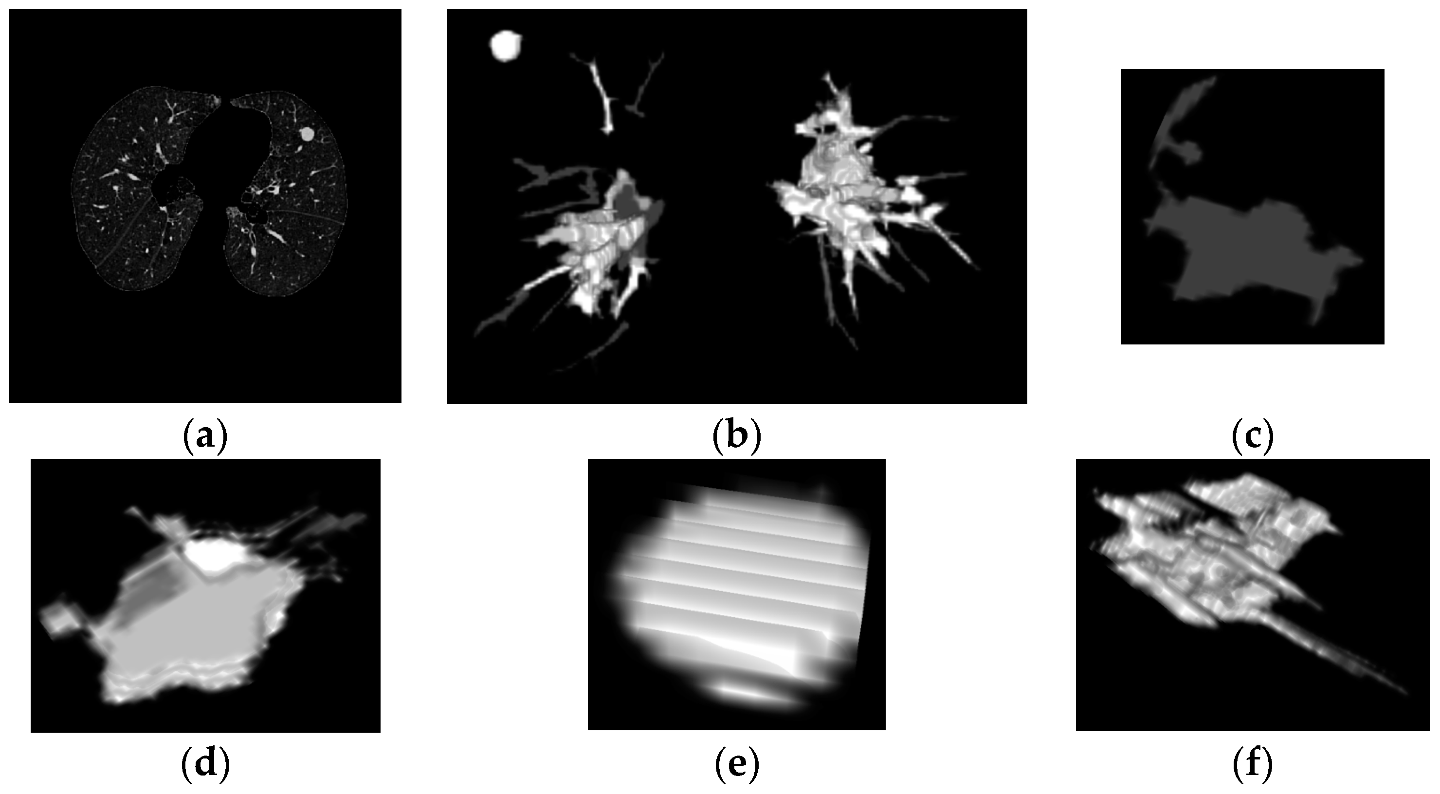 Diagnostics 06 00013 g006 1024