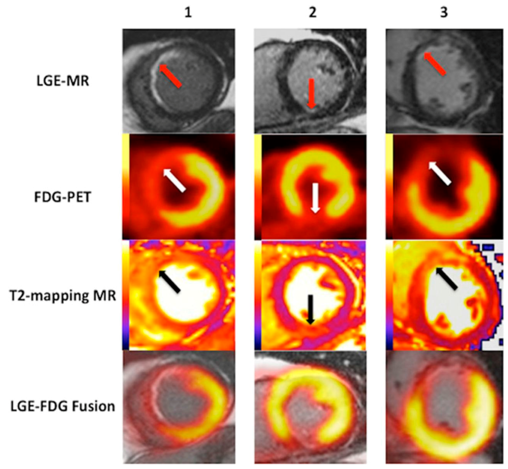 Clinical Utility and Future Applications of PET/CT and PET/CMR in ...