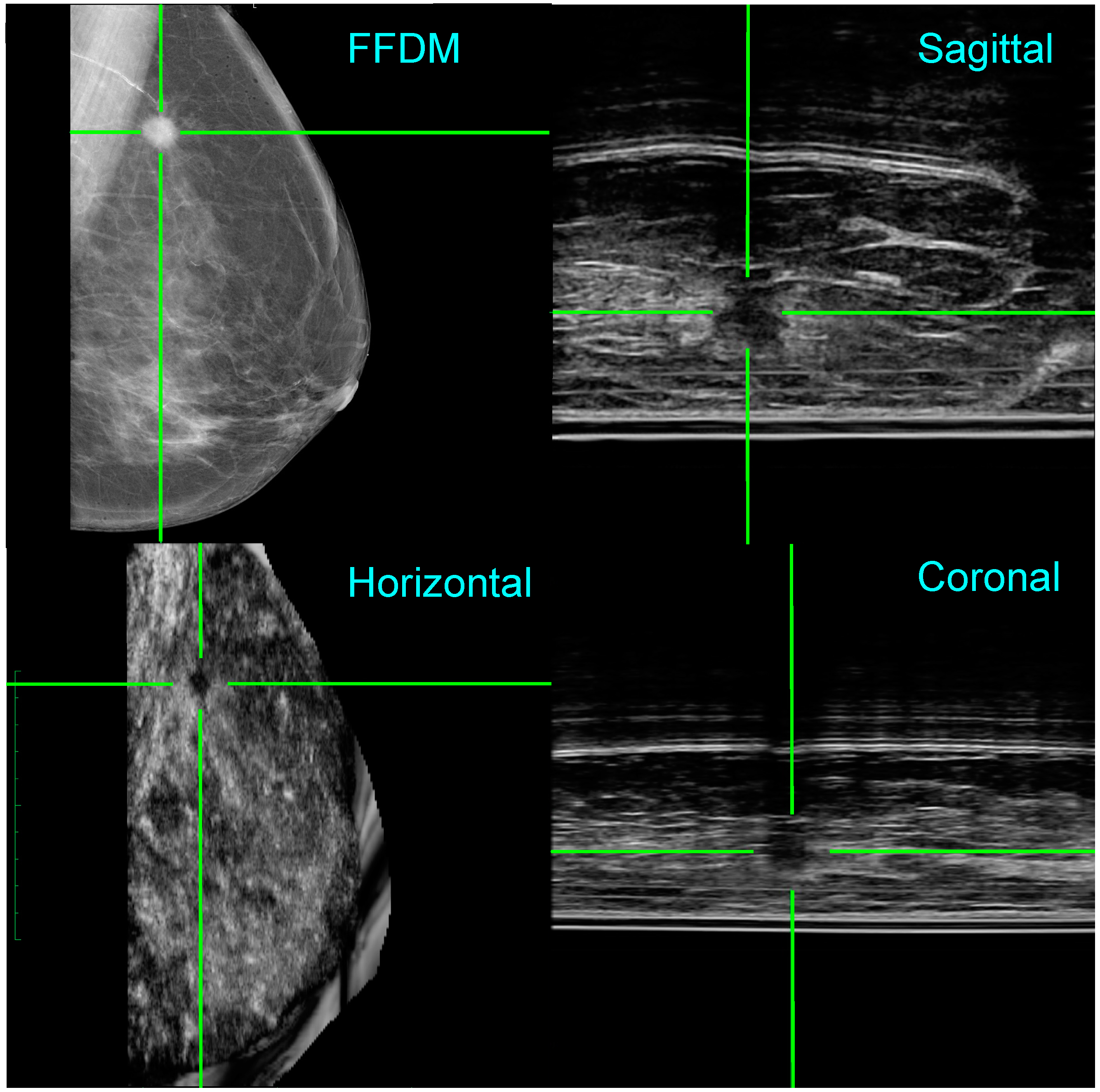 Diagnostics 07 00017 g005