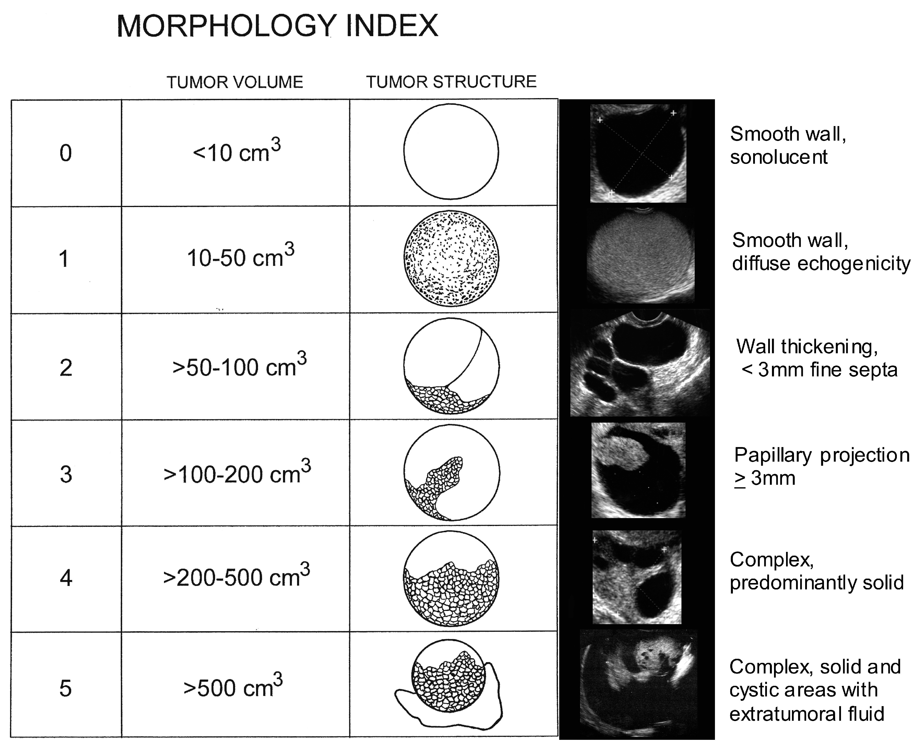 Ovarian Cyst Size Chart