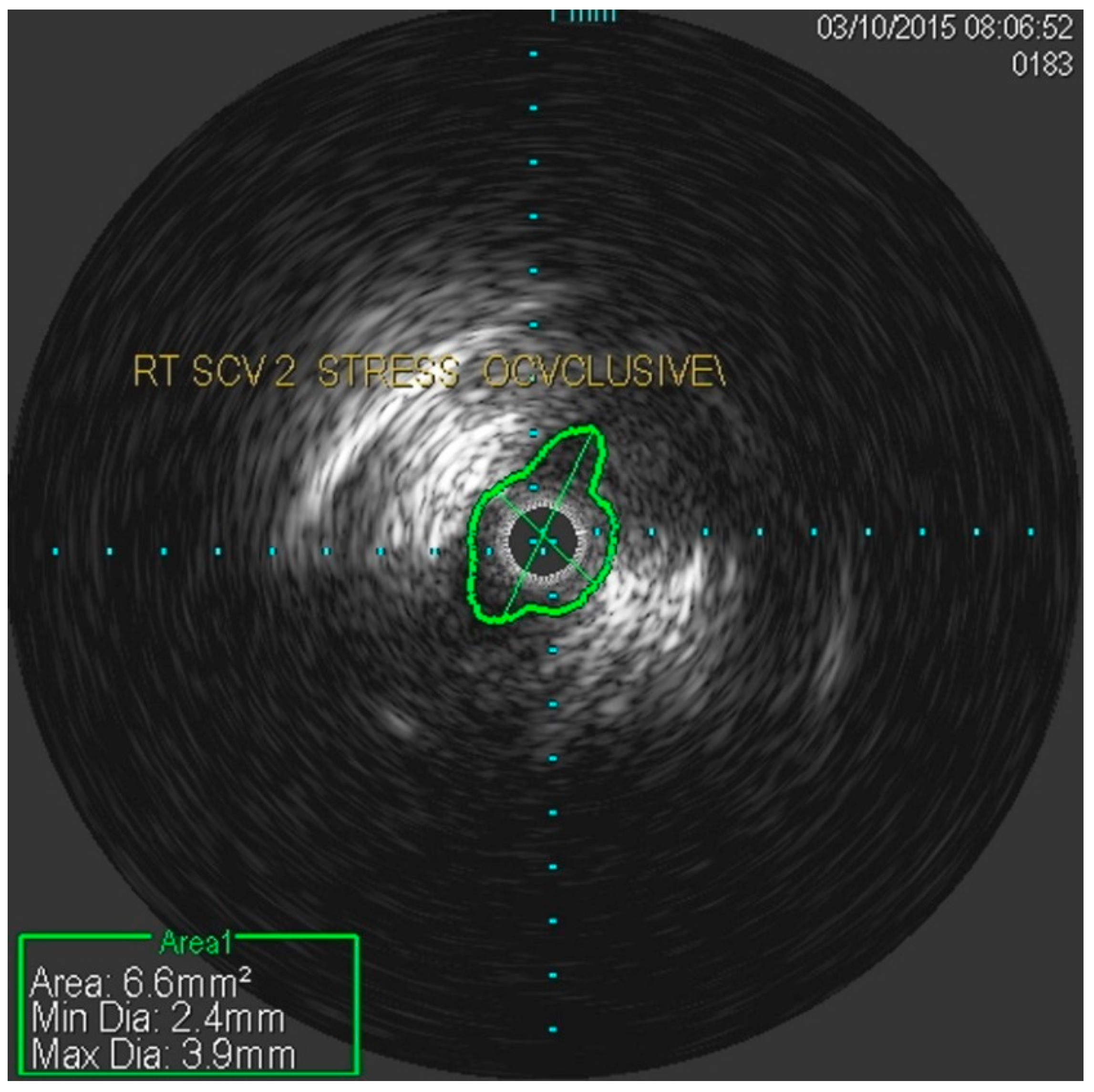 Diagnostics 07 00034 g004 550