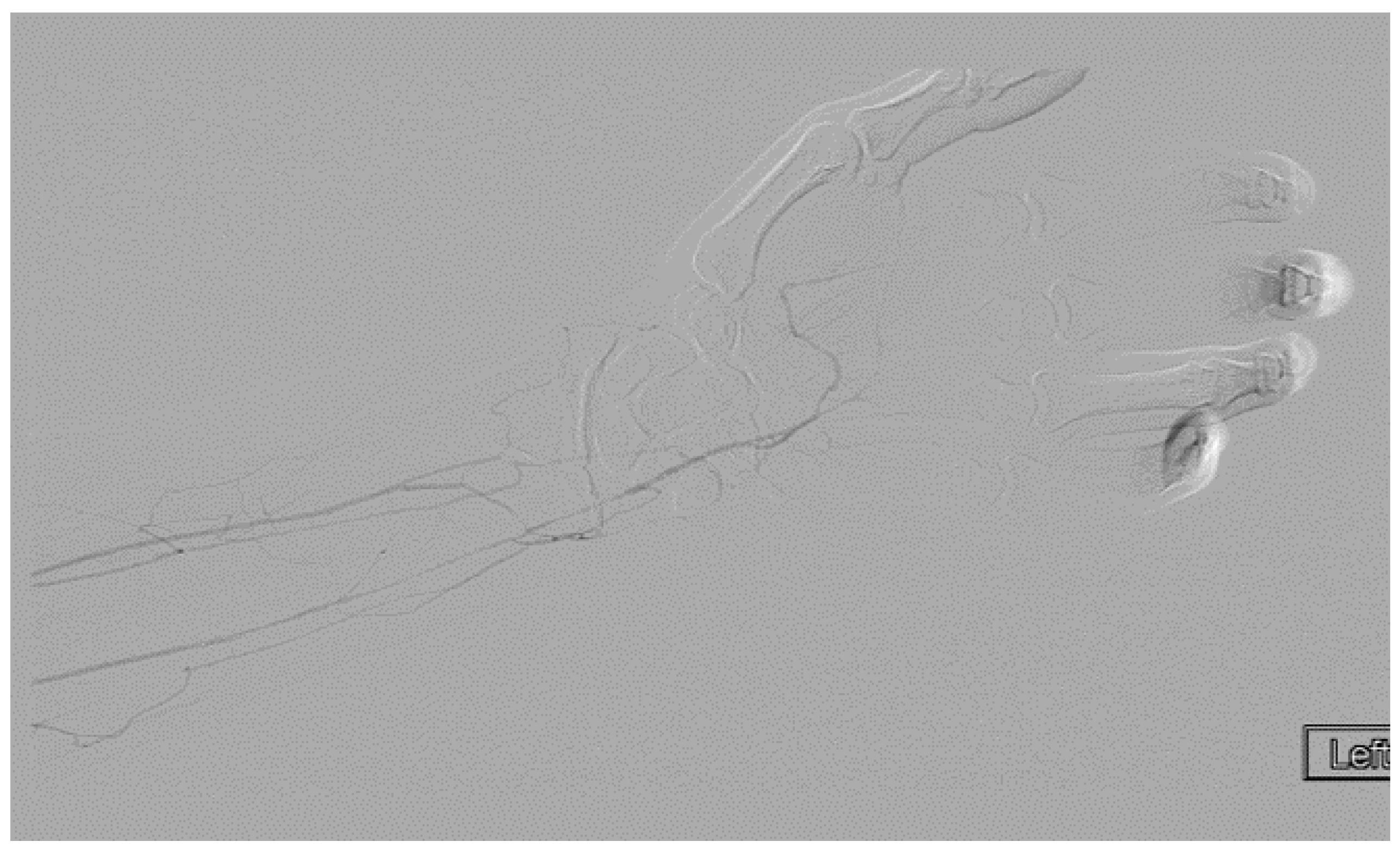 Diagnostics 07 00034 g010 550