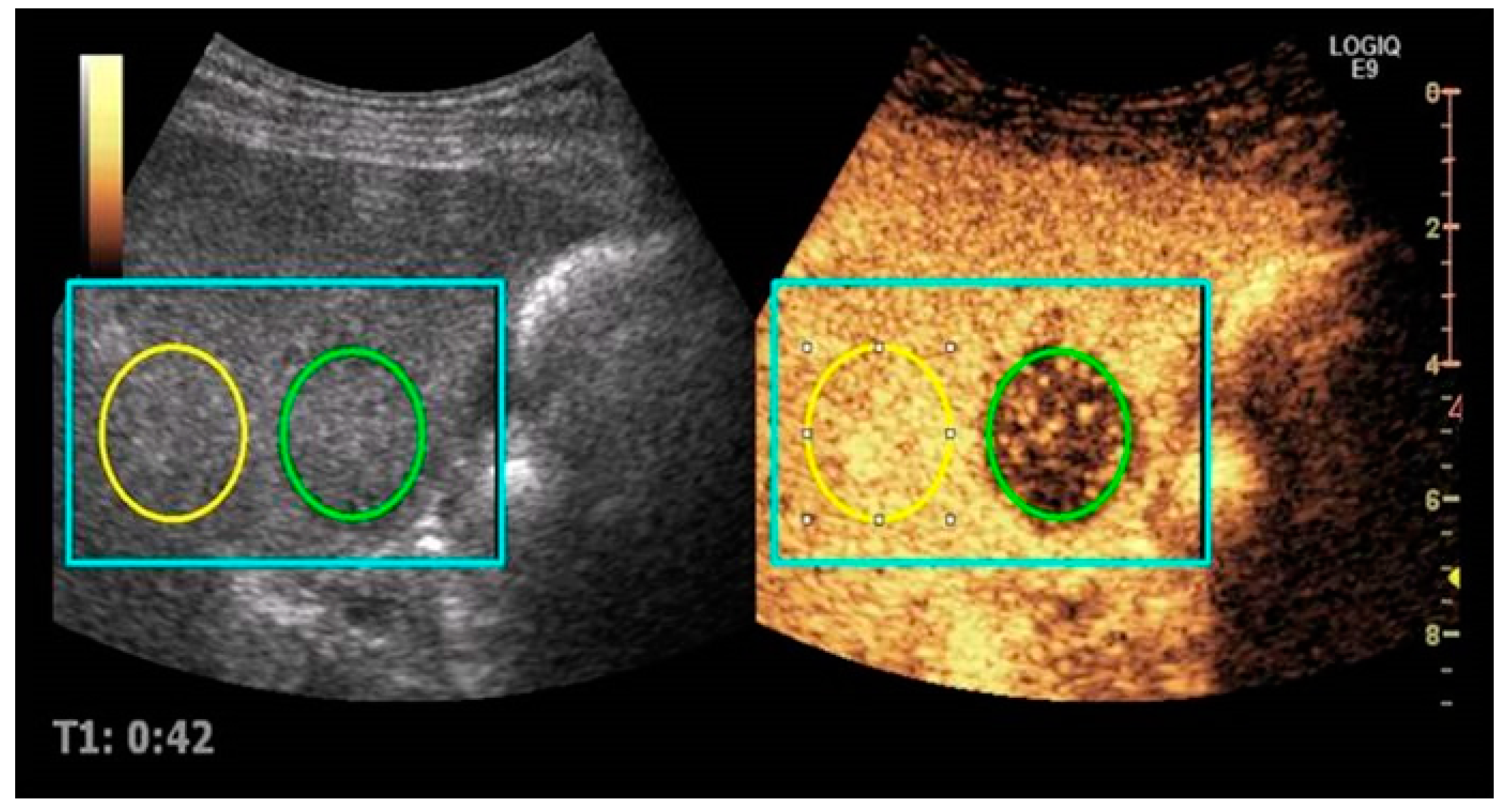 Diagnostics 07 00035 g001 550