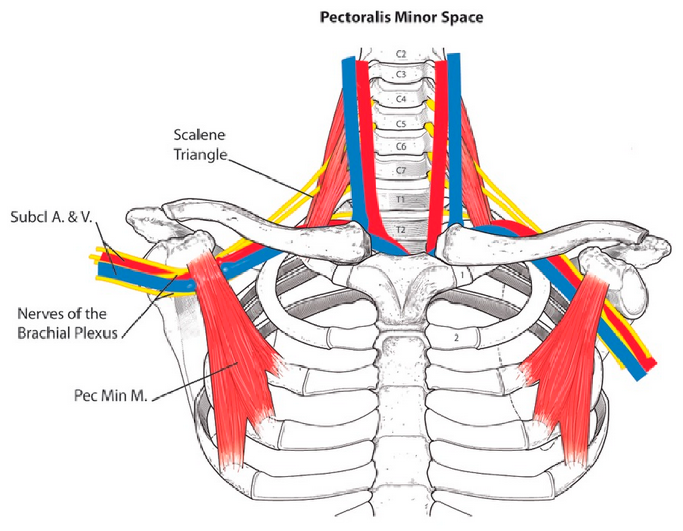 Diagnostics | Free Full-Text | Pectoralis Minor Syndrome: Subclavicular