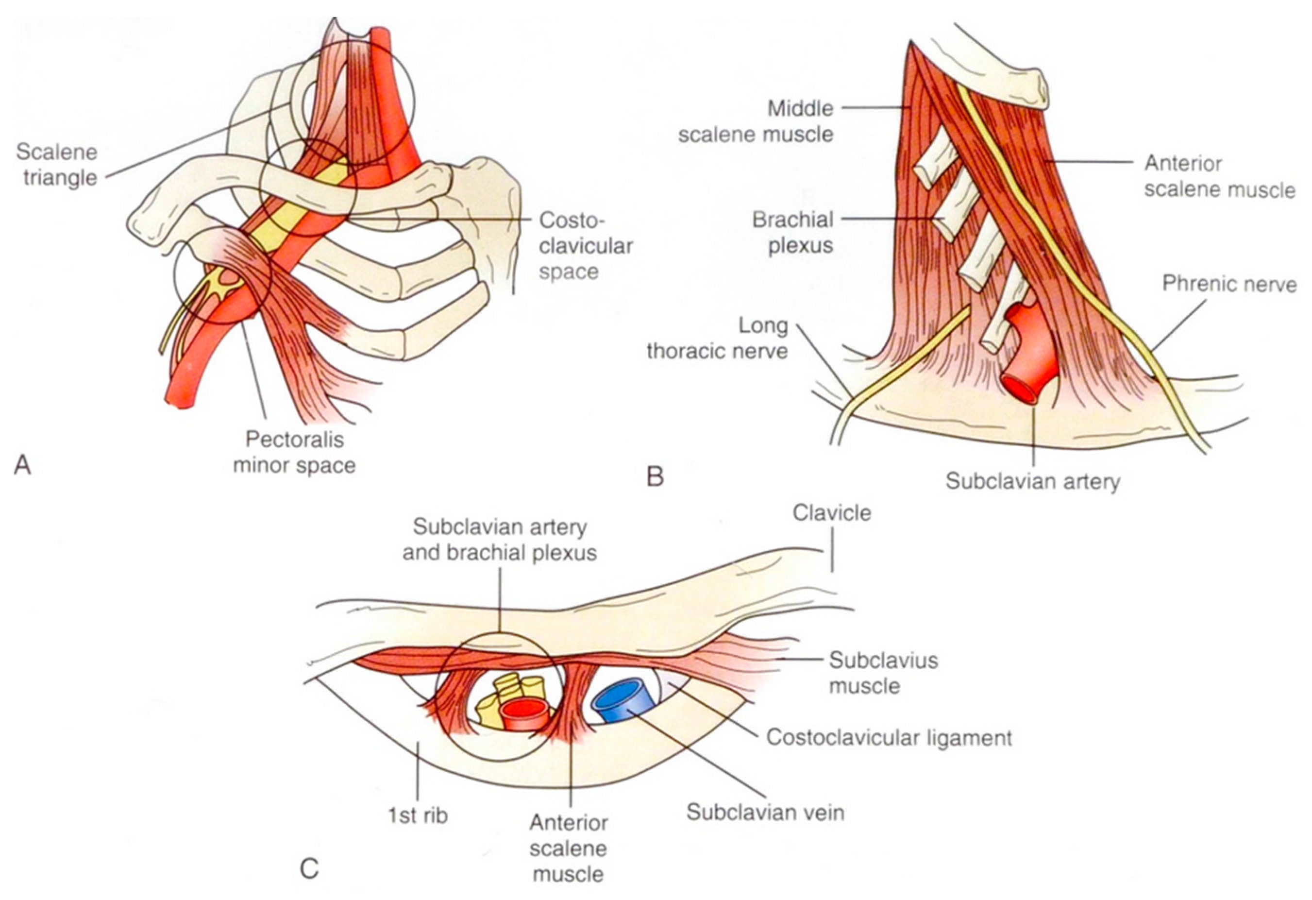 Diagnostics | Free Full-Text | Pectoralis Minor Syndrome: Subclavicular