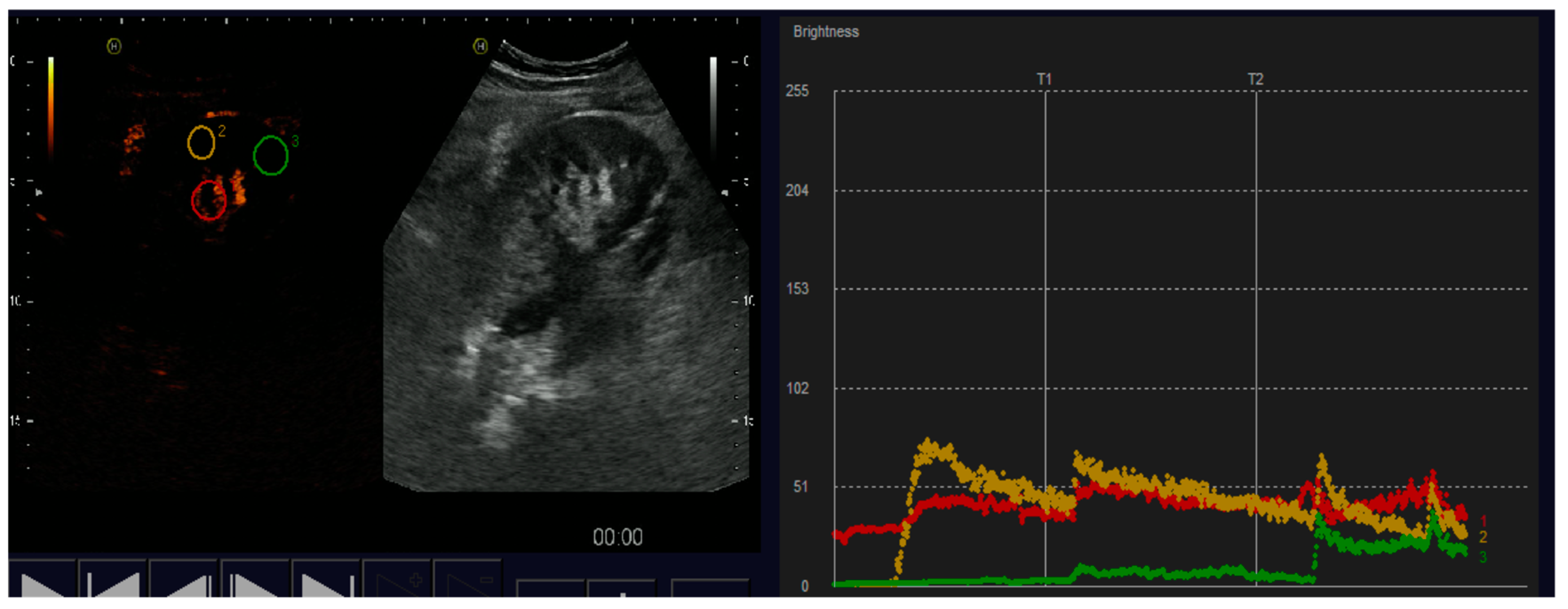 Diagnostics 07 00053 g003 Diagnostics 07 00053 g003