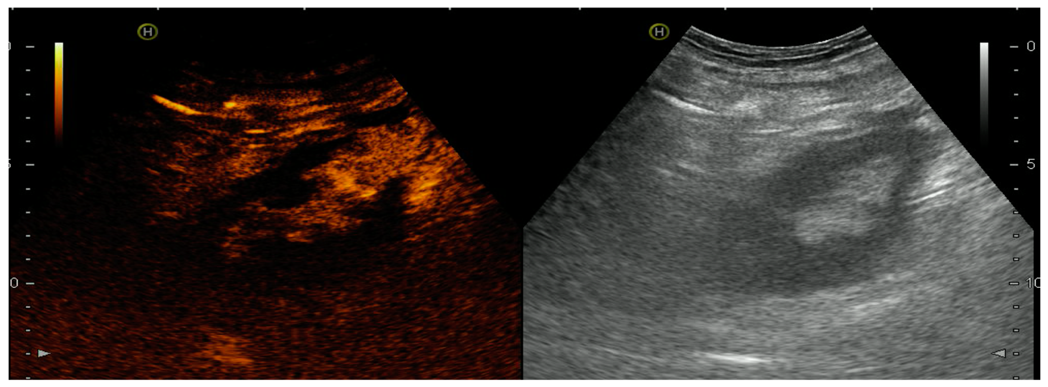 Diagnostics 07 00053 g004 Diagnostics 07 00053 g004