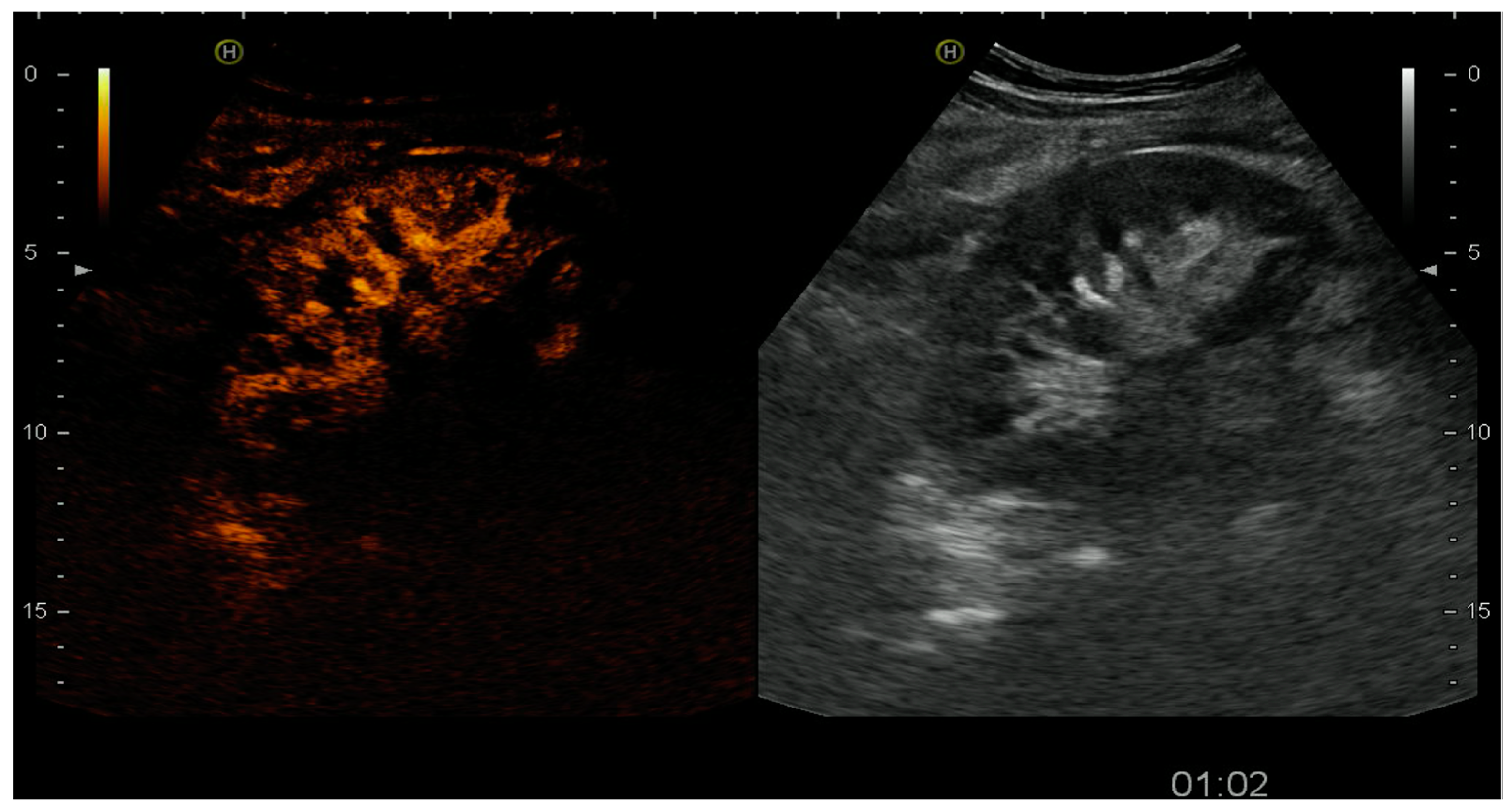 Diagnostics 07 00053 g005 Diagnostics 07 00053 g005