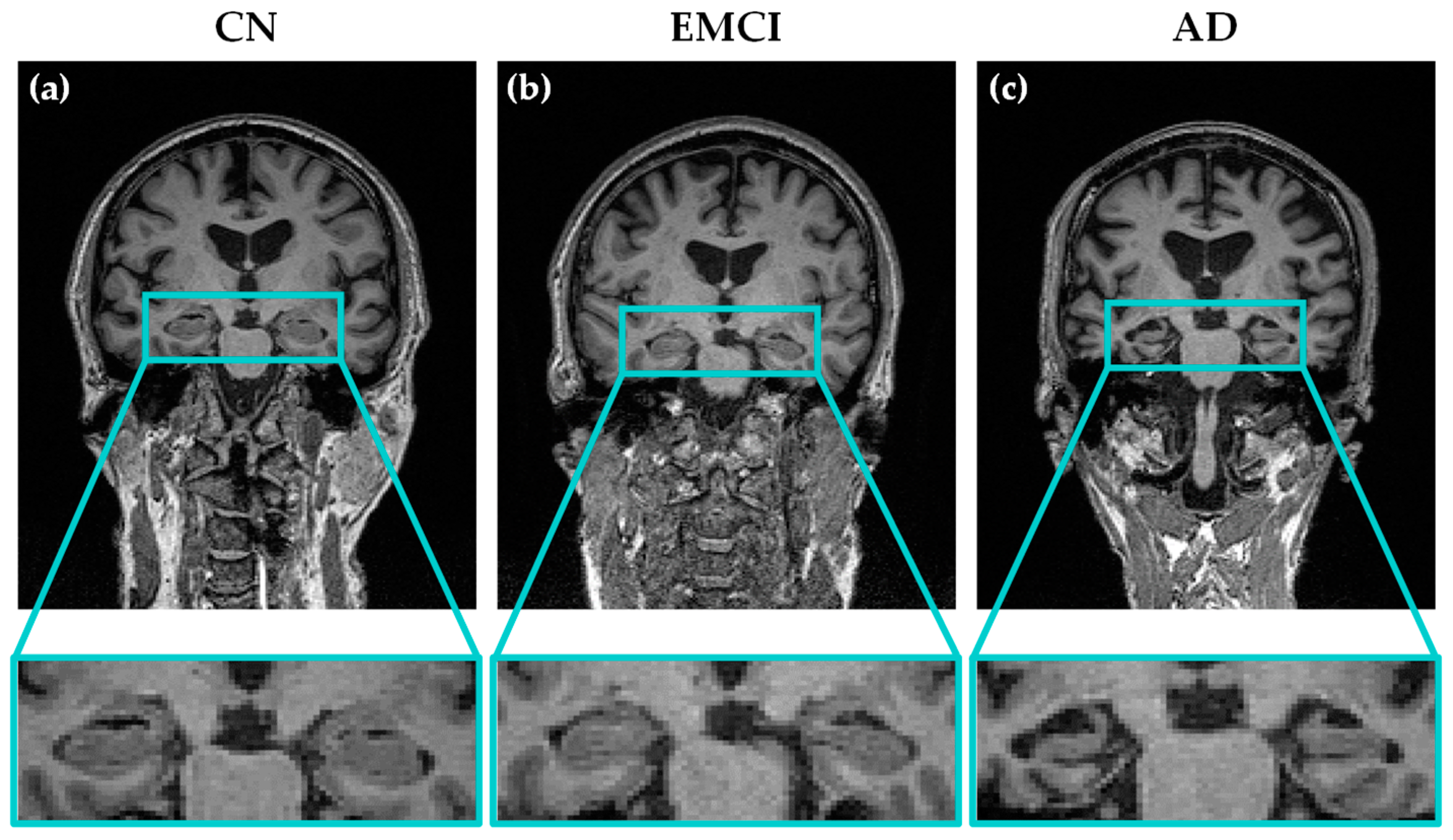 Diagnostics 08 00047 g001 Diagnostics 08 00047 g001