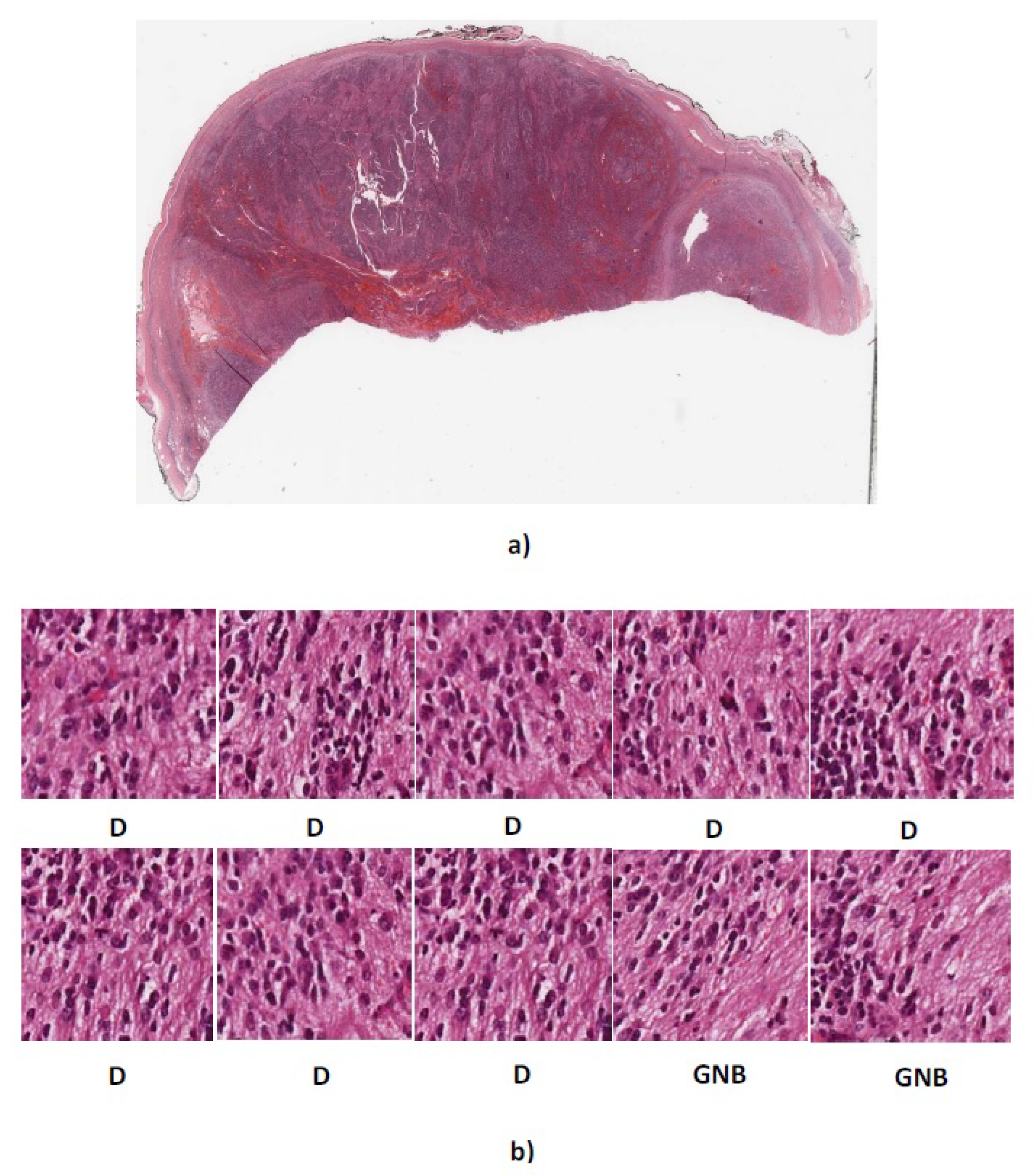 Diagnostics 08 00056 g012