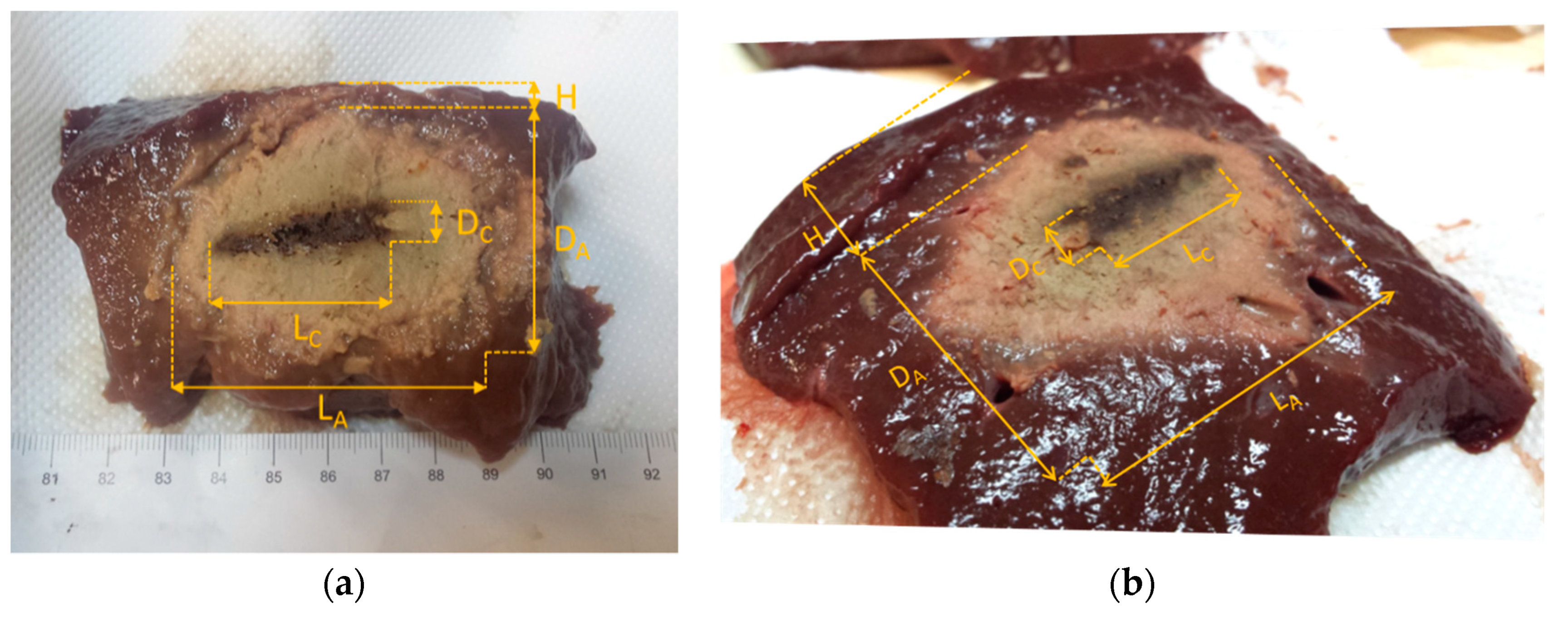 Diagnostics 08 00081 g006 Diagnostics 08 00081 g006