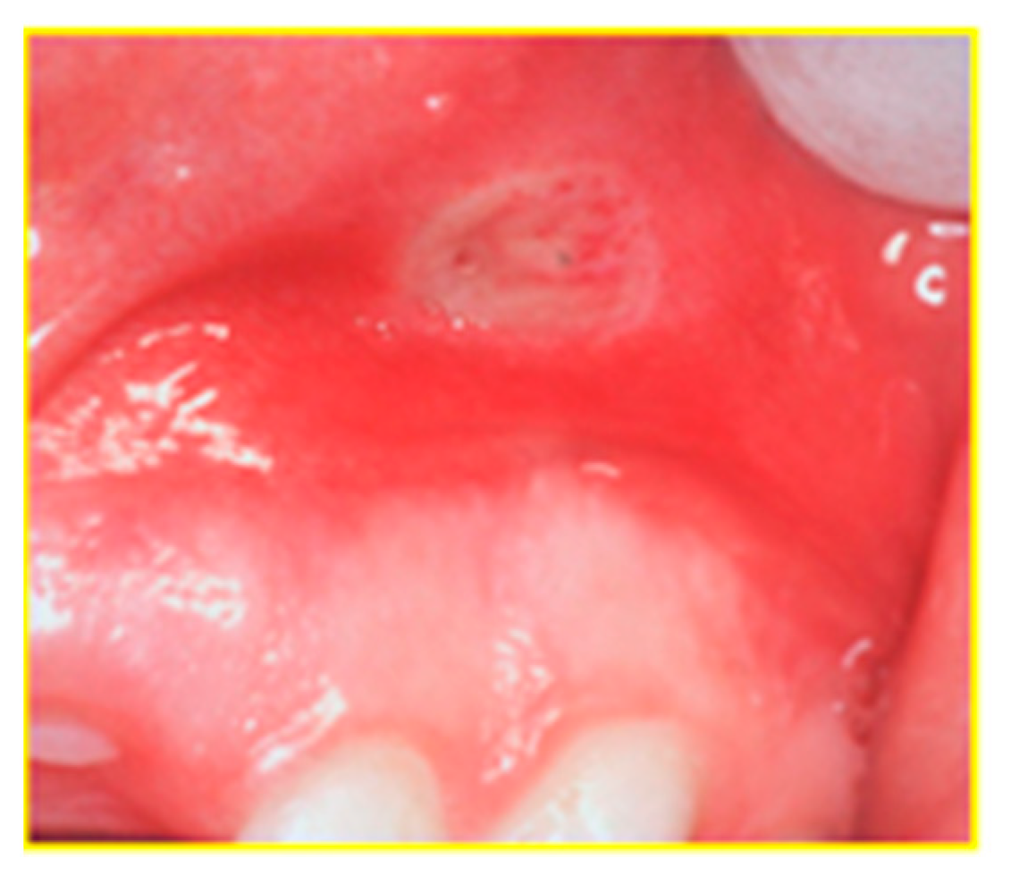 Diagnostics 09 00077 g003 Diagnostics 09 00077 g003