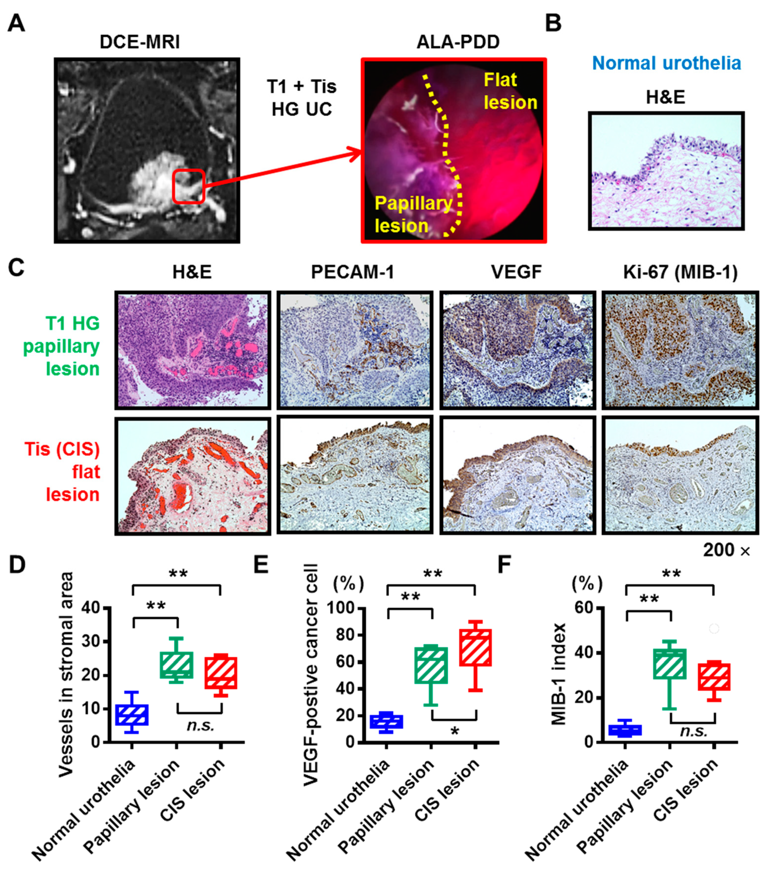 Diagnostics Free Full Text A Potential Application Of Dynamic Contrast Enhanced Magnetic Resonance Imaging Combined With Photodynamic Diagnosis For The Detection Of Bladder Carcinoma In Situ Toward The Future Mri Pdd Fusion Turbt