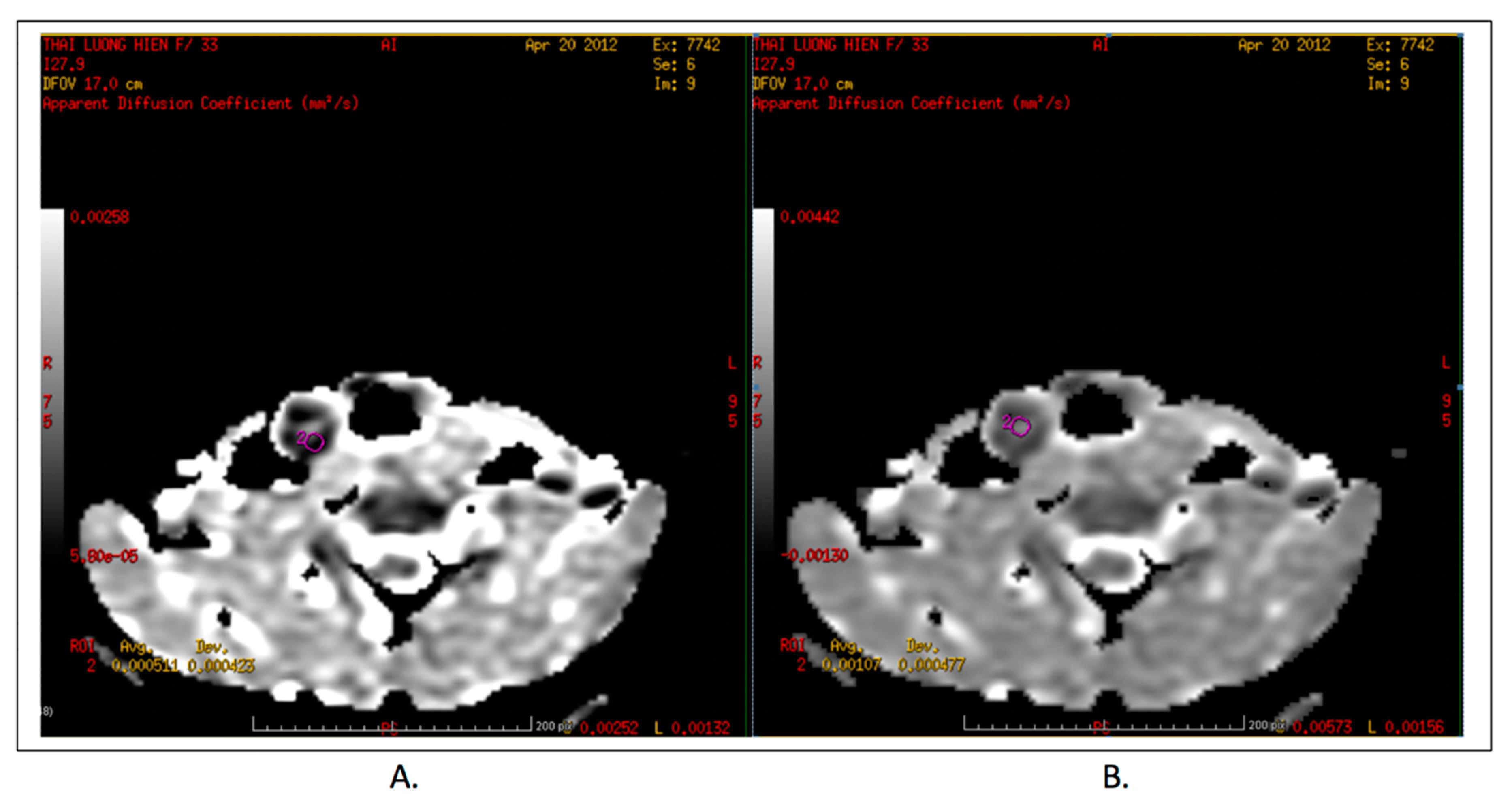 denville diagnostics mri denville diagnostics mri
