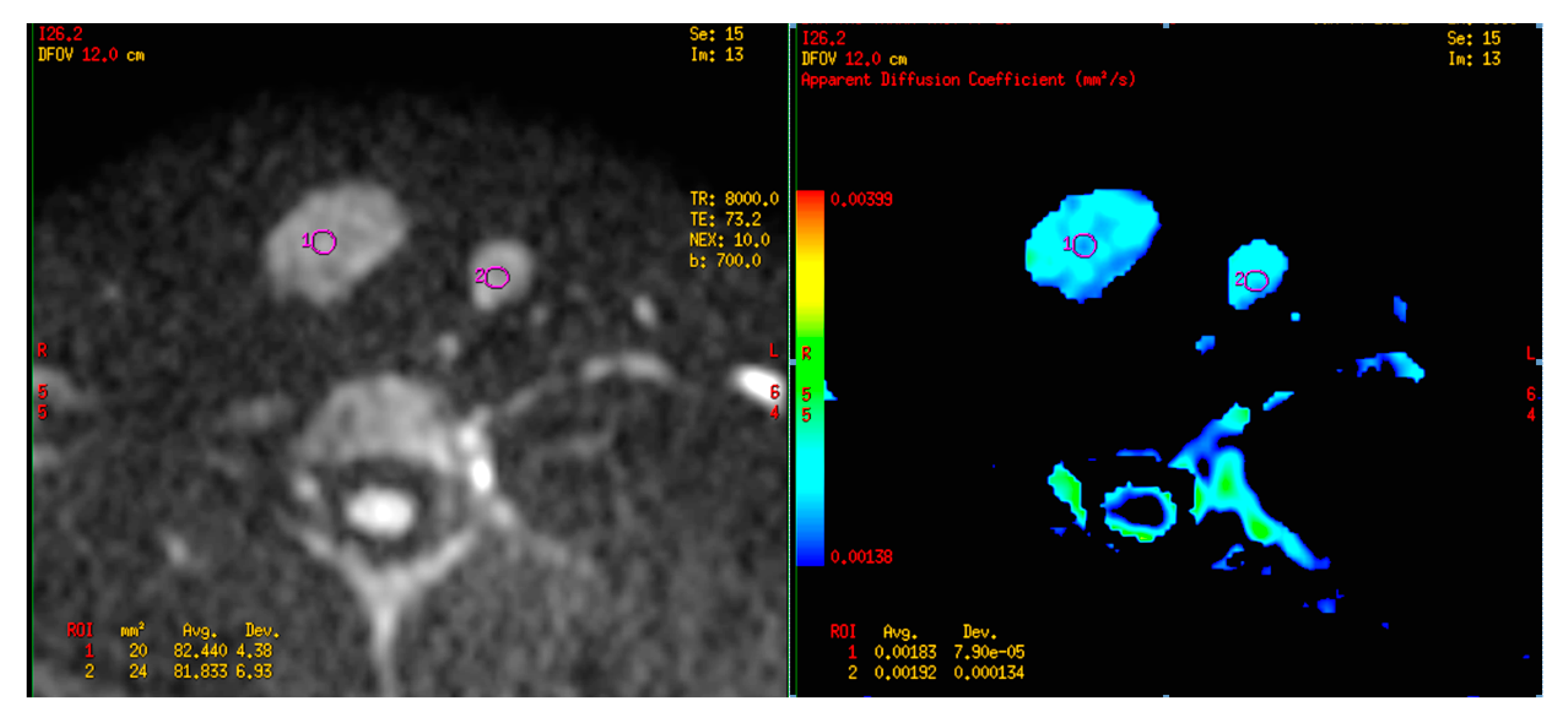 Diagnostics 09 00129 g004 Diagnostics 09 00129 g004