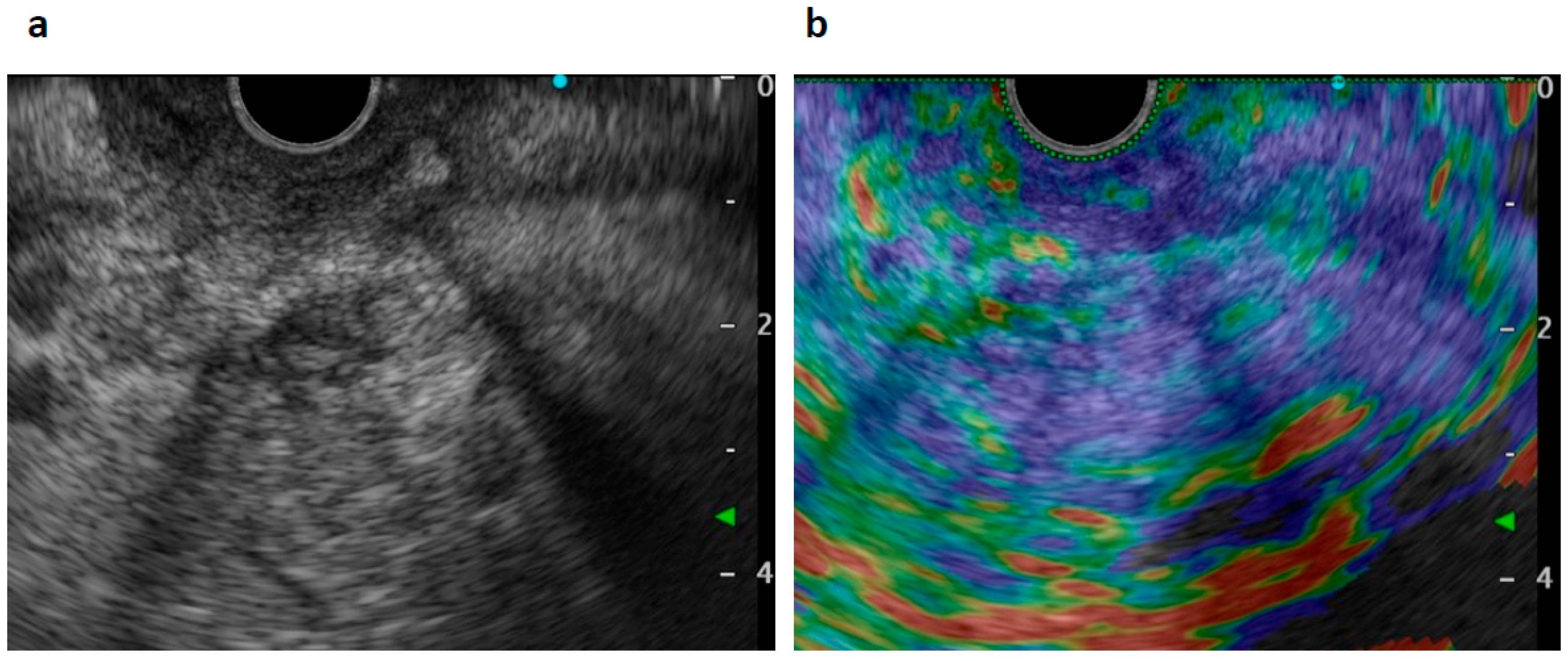 Diagnostics 09 00150 g003 Diagnostics 09 00150 g003