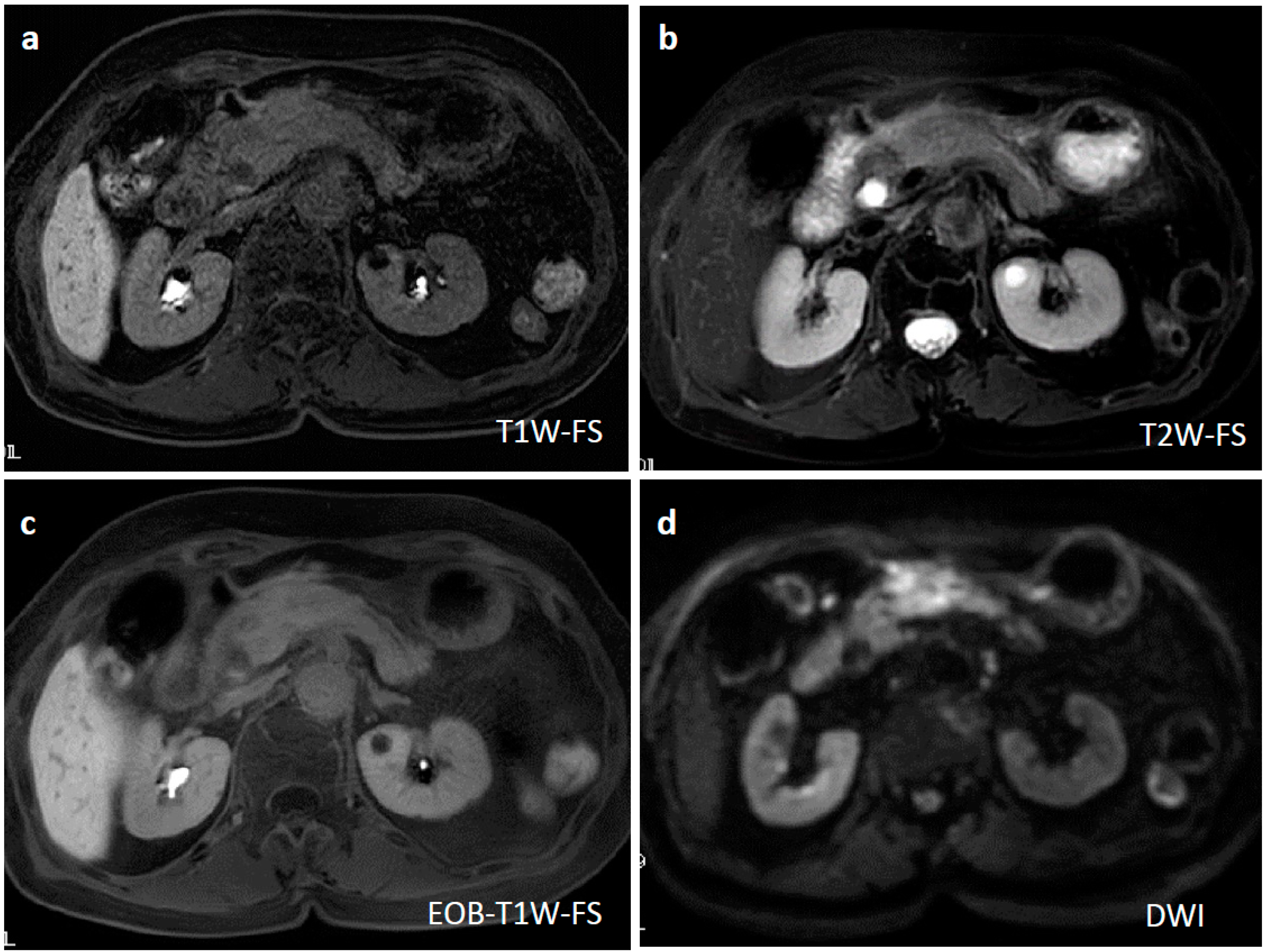 Diagnostics 09 00150 g006 Diagnostics 09 00150 g006