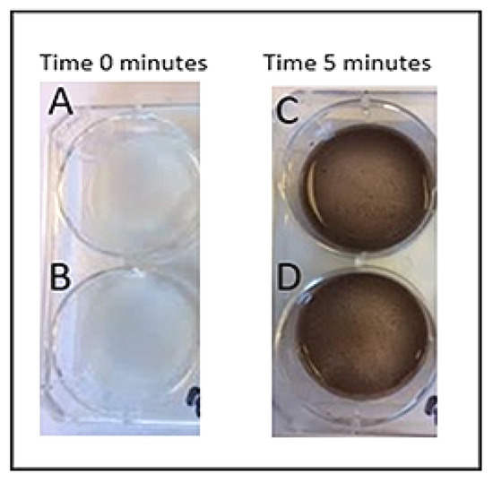 15 Minutes Rapid Detect Uric Acid Meter For Hospital Dry Chemistry