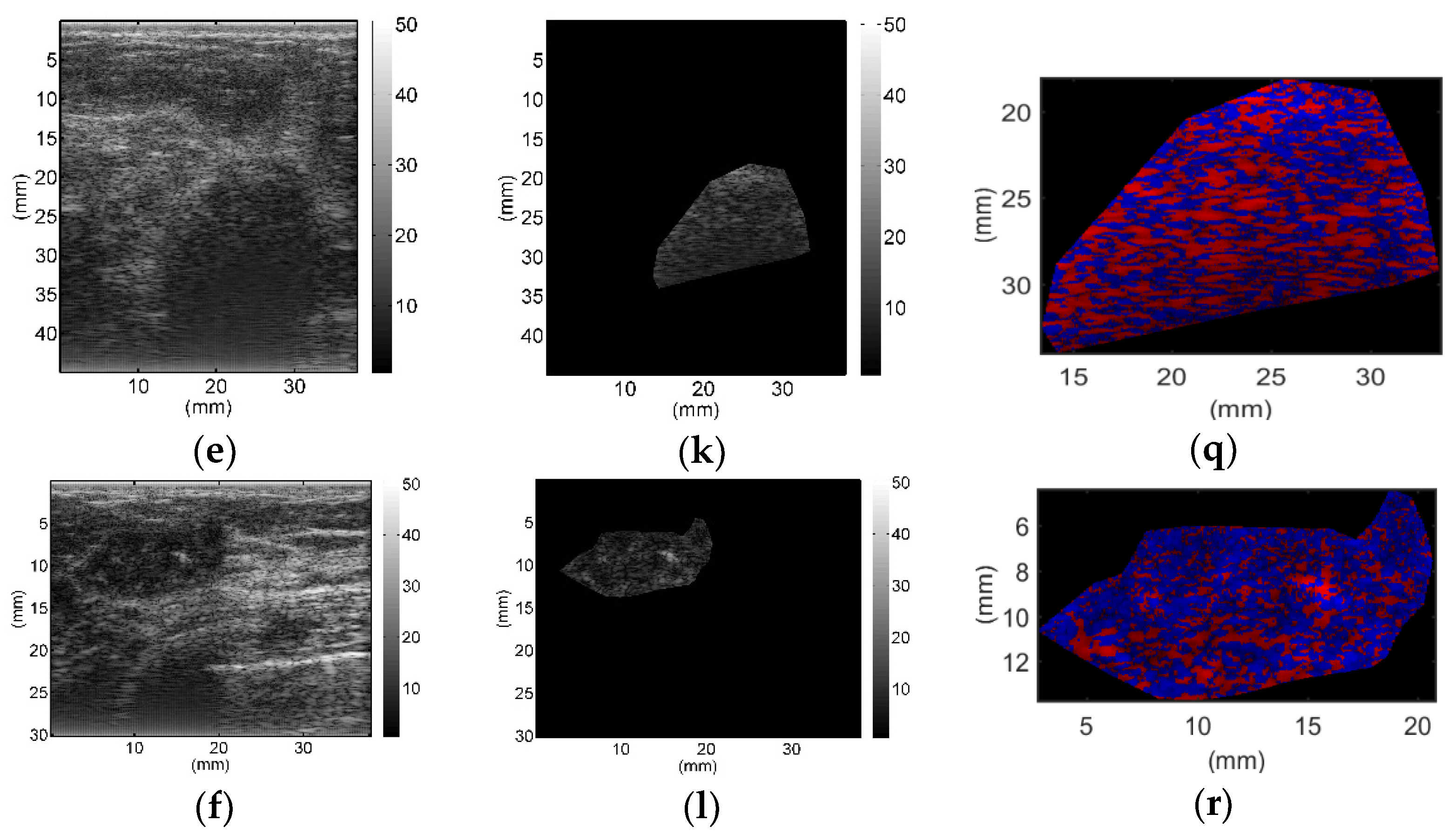 Diagnostics Free Full Text Classification Of Benign And Malignant Breast Tumors Using H Scan Ultrasound Imaging Html