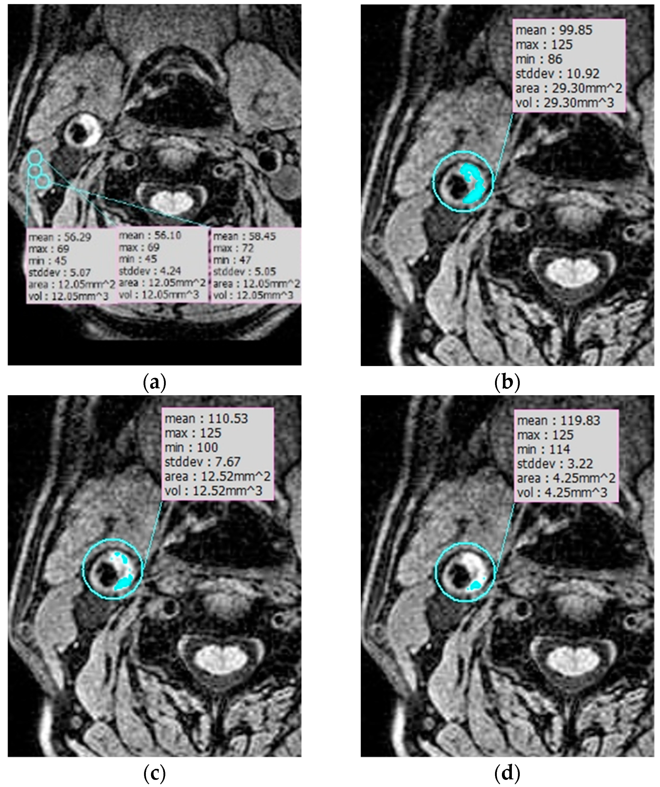 Diagnostics 09 00184 g002 Diagnostics 09 00184 g002