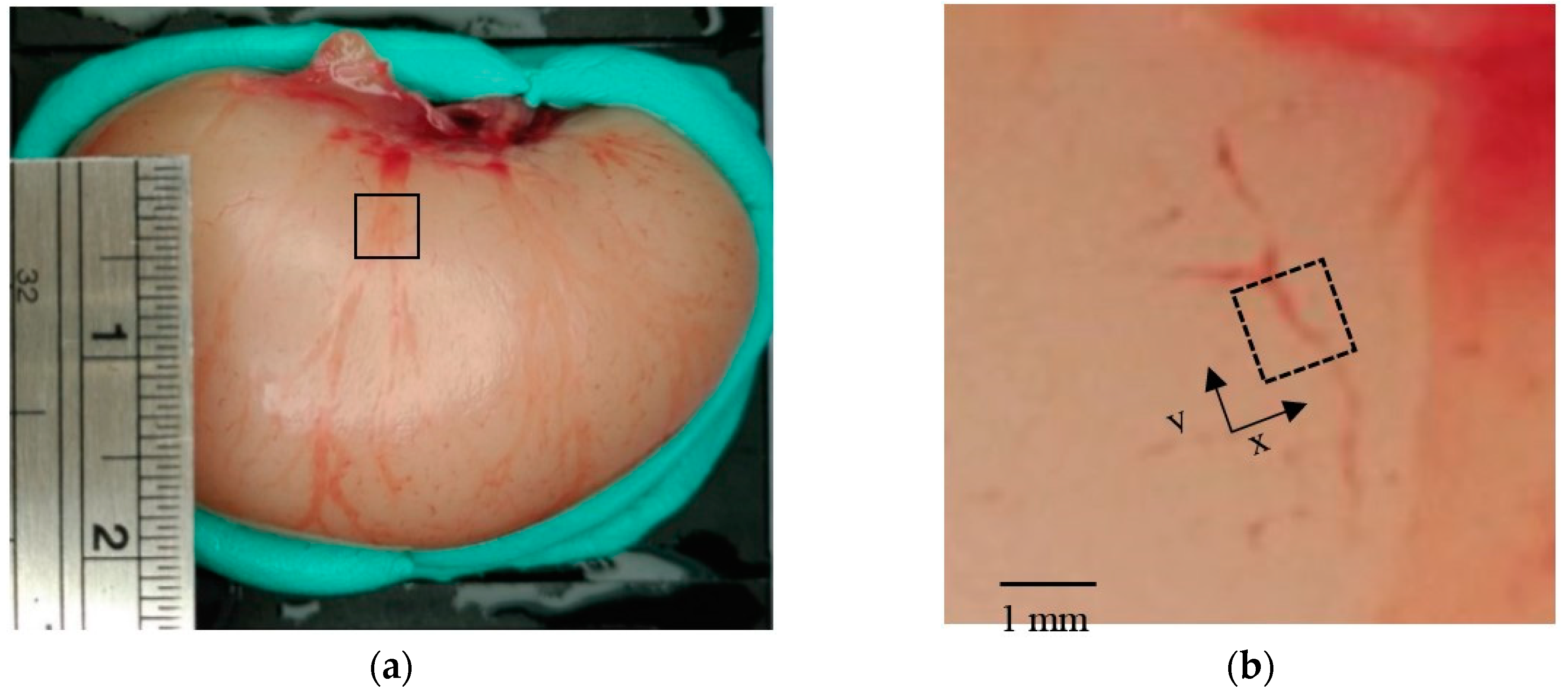 Diagnostics 10 00006 g011 Diagnostics 10 00006 g011