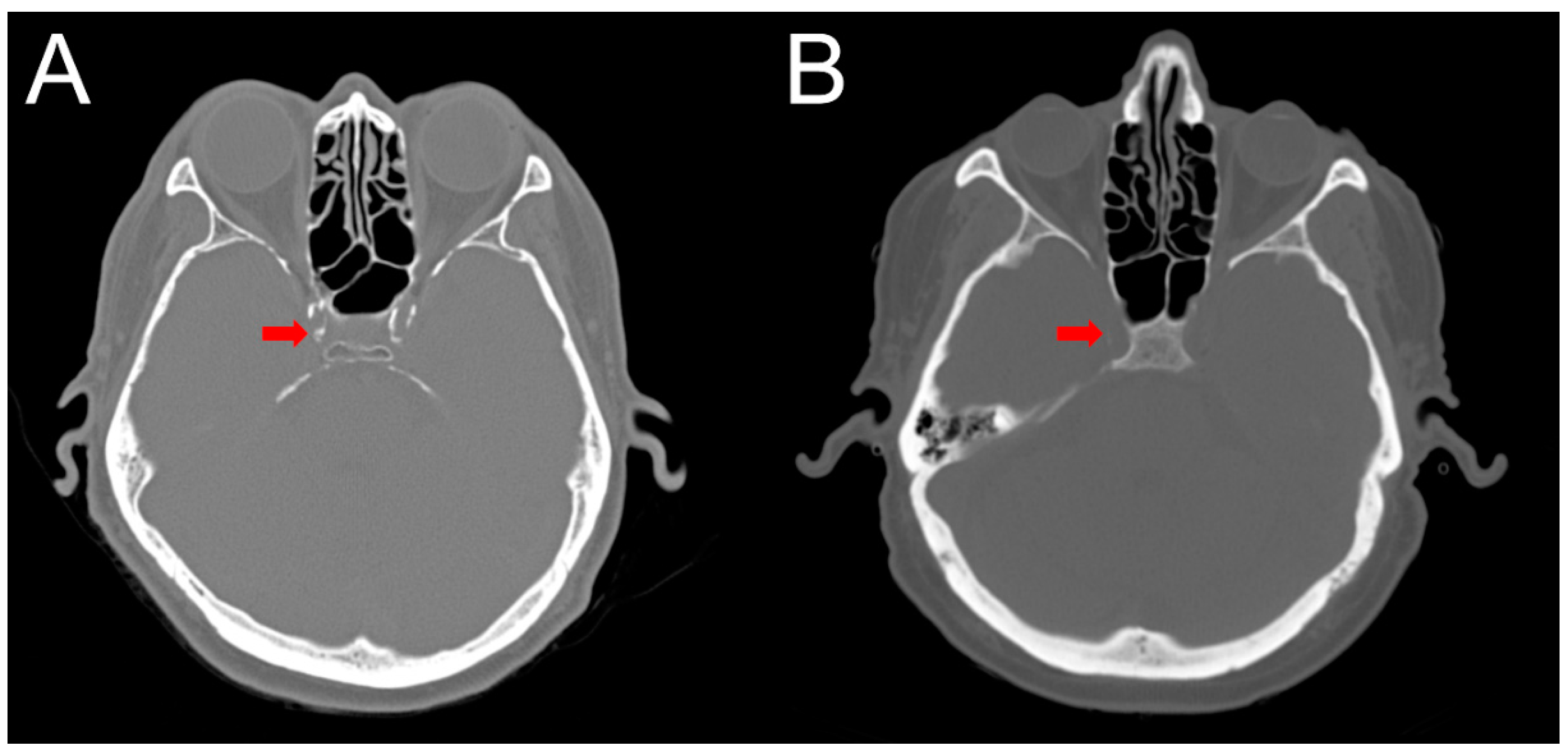 Diagnostics 10 00018 g002 Diagnostics 10 00018 g002