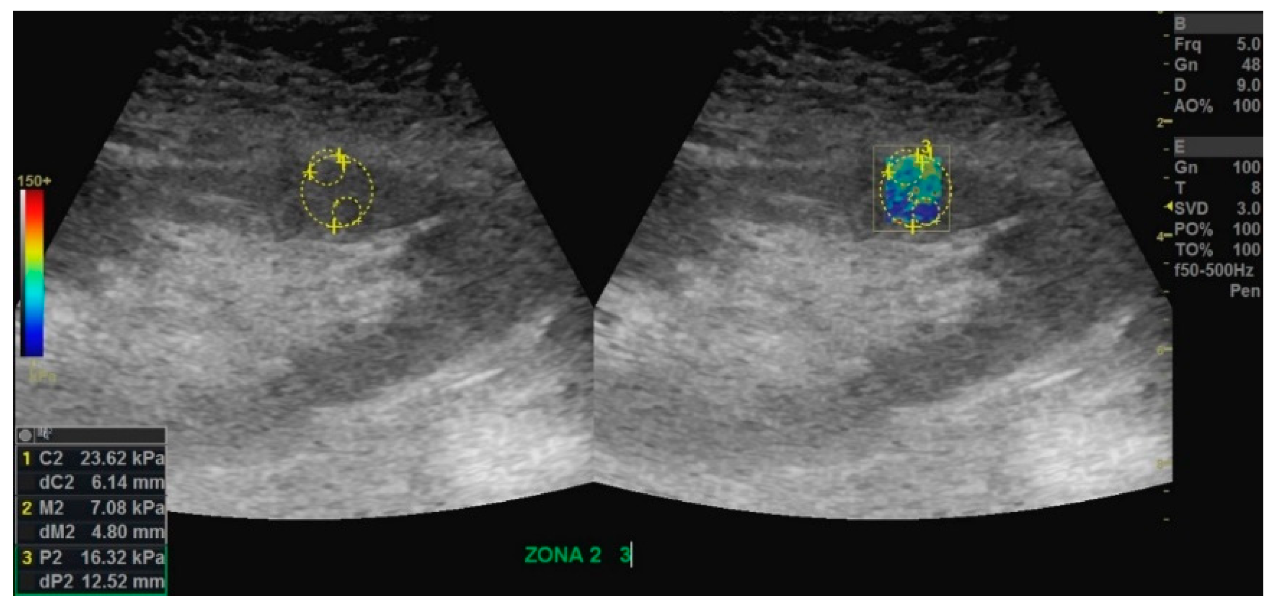 Diagnostics 10 00041 g002 Diagnostics 10 00041 g002