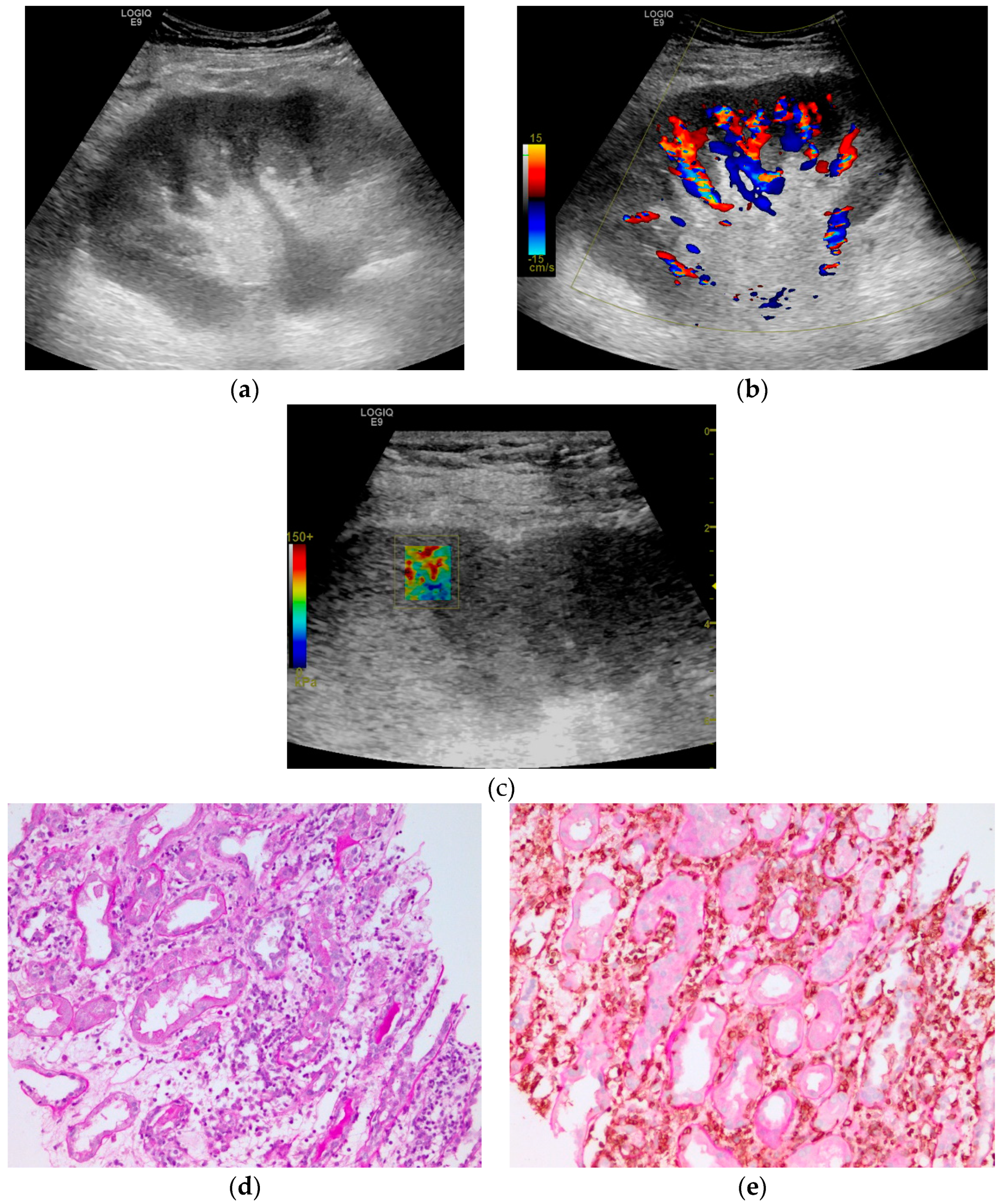 Diagnostics 10 00041 g004 Diagnostics 10 00041 g004
