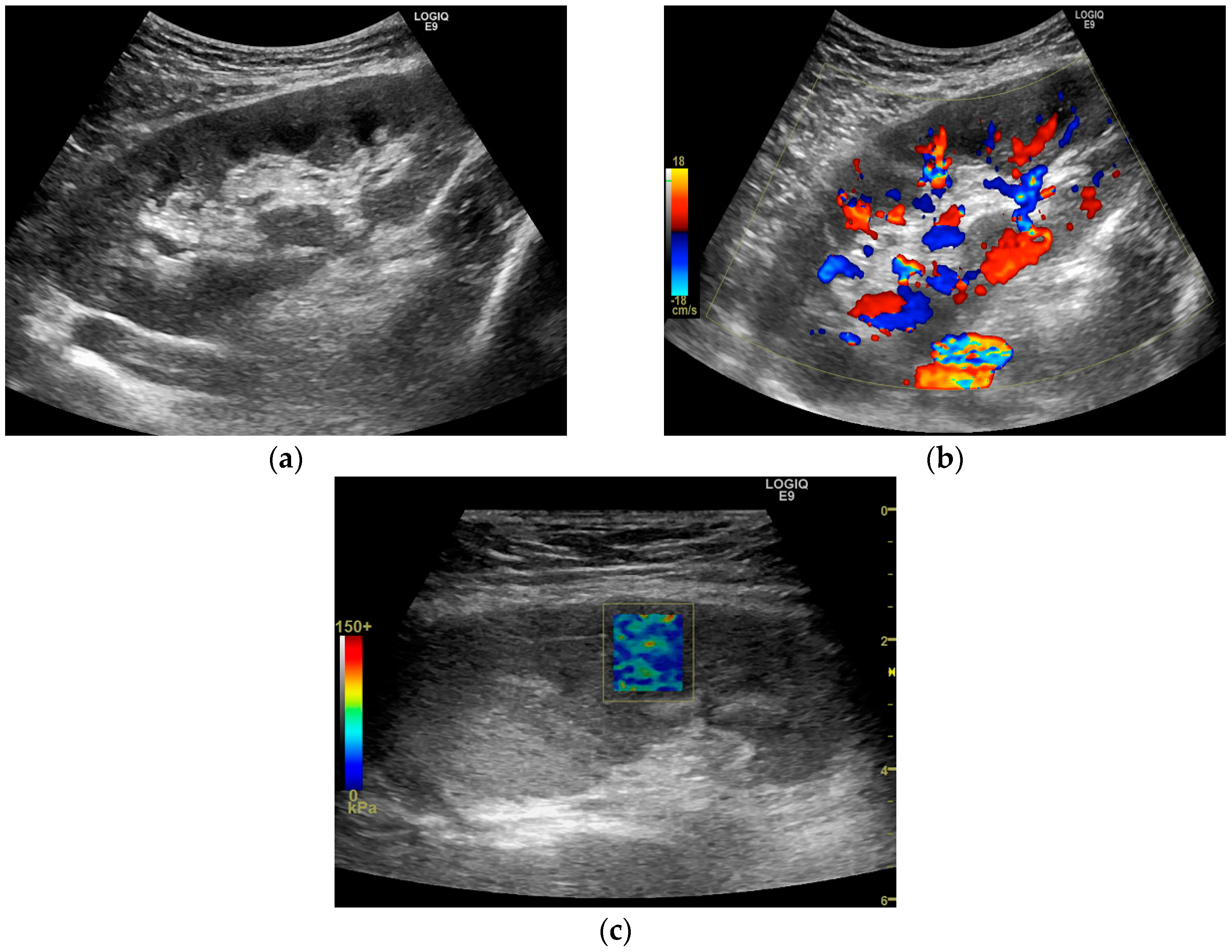 Diagnostics 10 00041 g005 Diagnostics 10 00041 g005