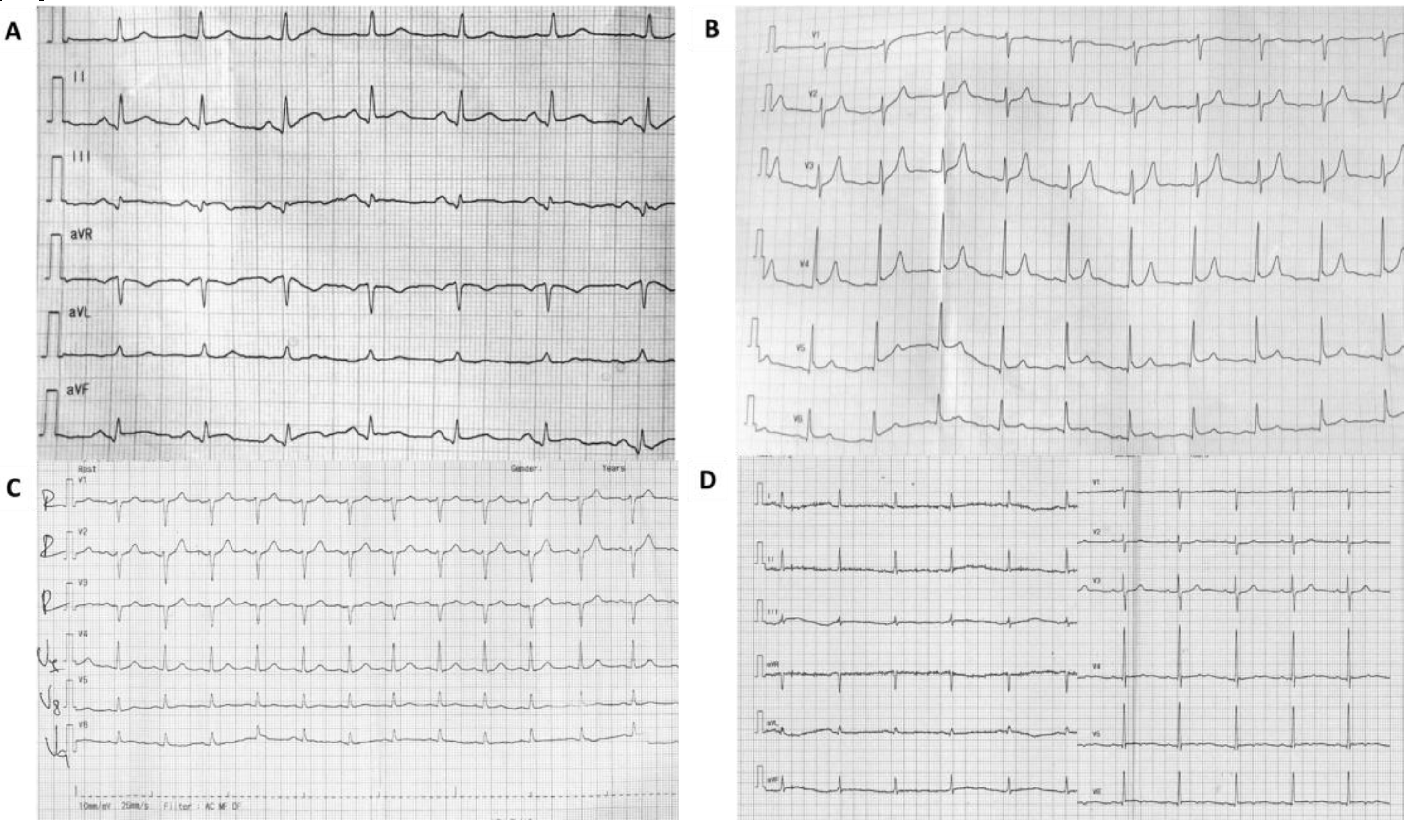 Diagnostics 10 00059 g002 Diagnostics 10 00059 g002