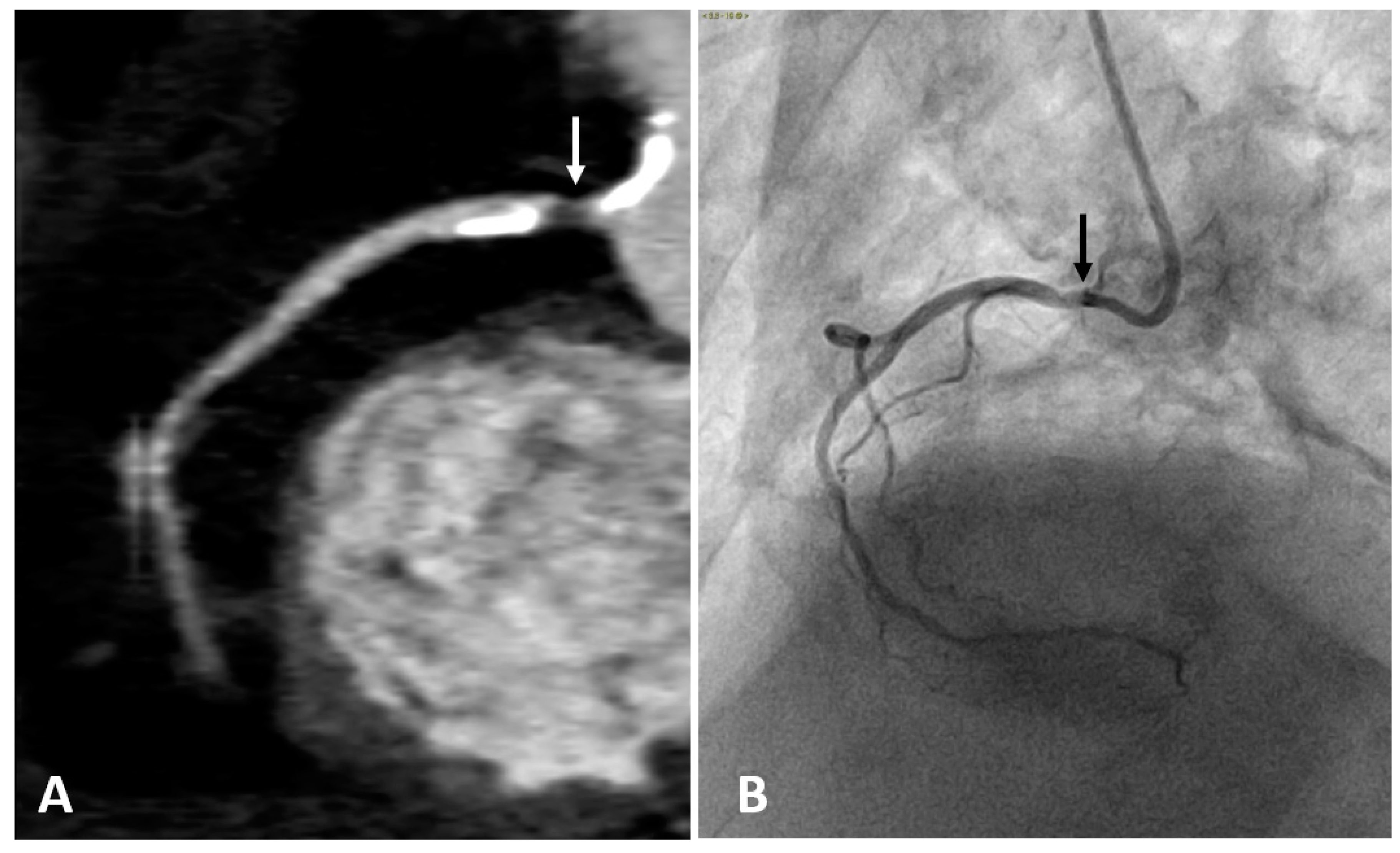 Diagnostics 10 00065 g002 Diagnostics 10 00065 g002