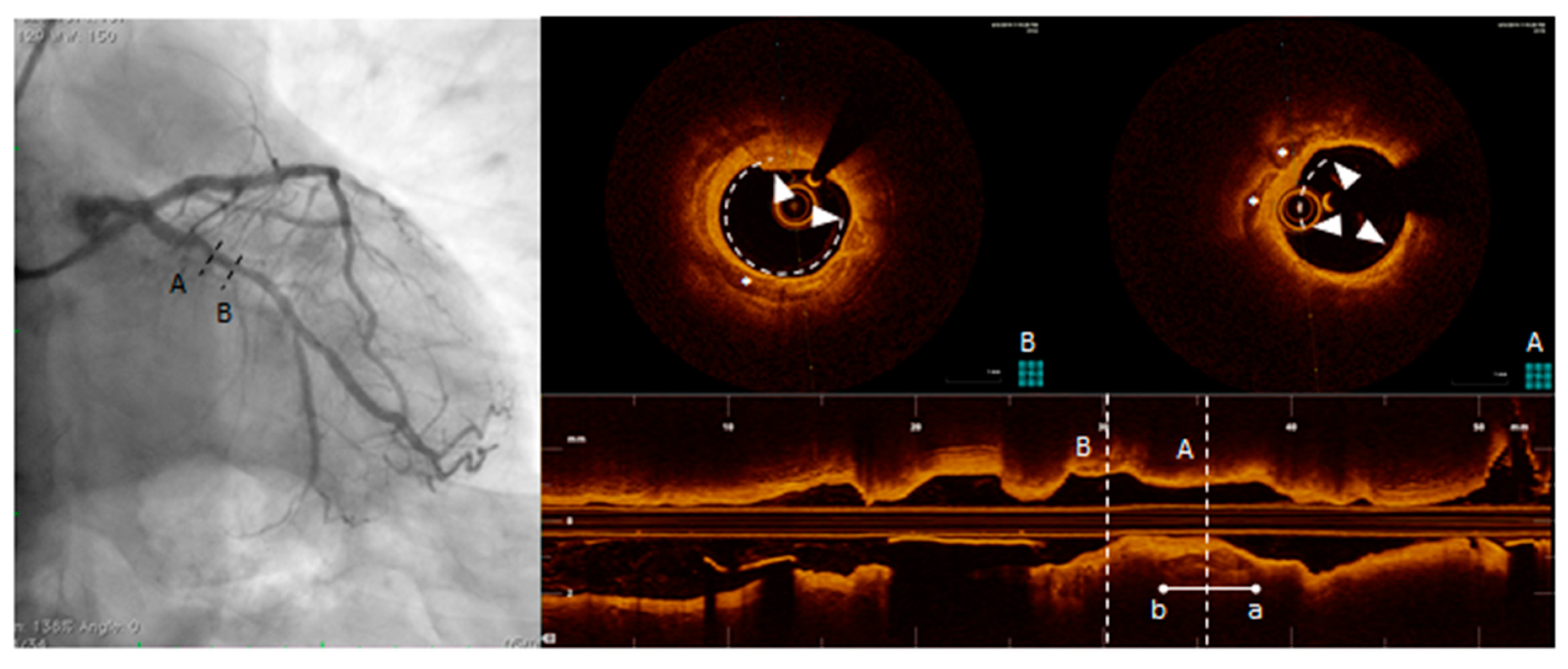 Diagnostics 10 00065 g006 Diagnostics 10 00065 g006