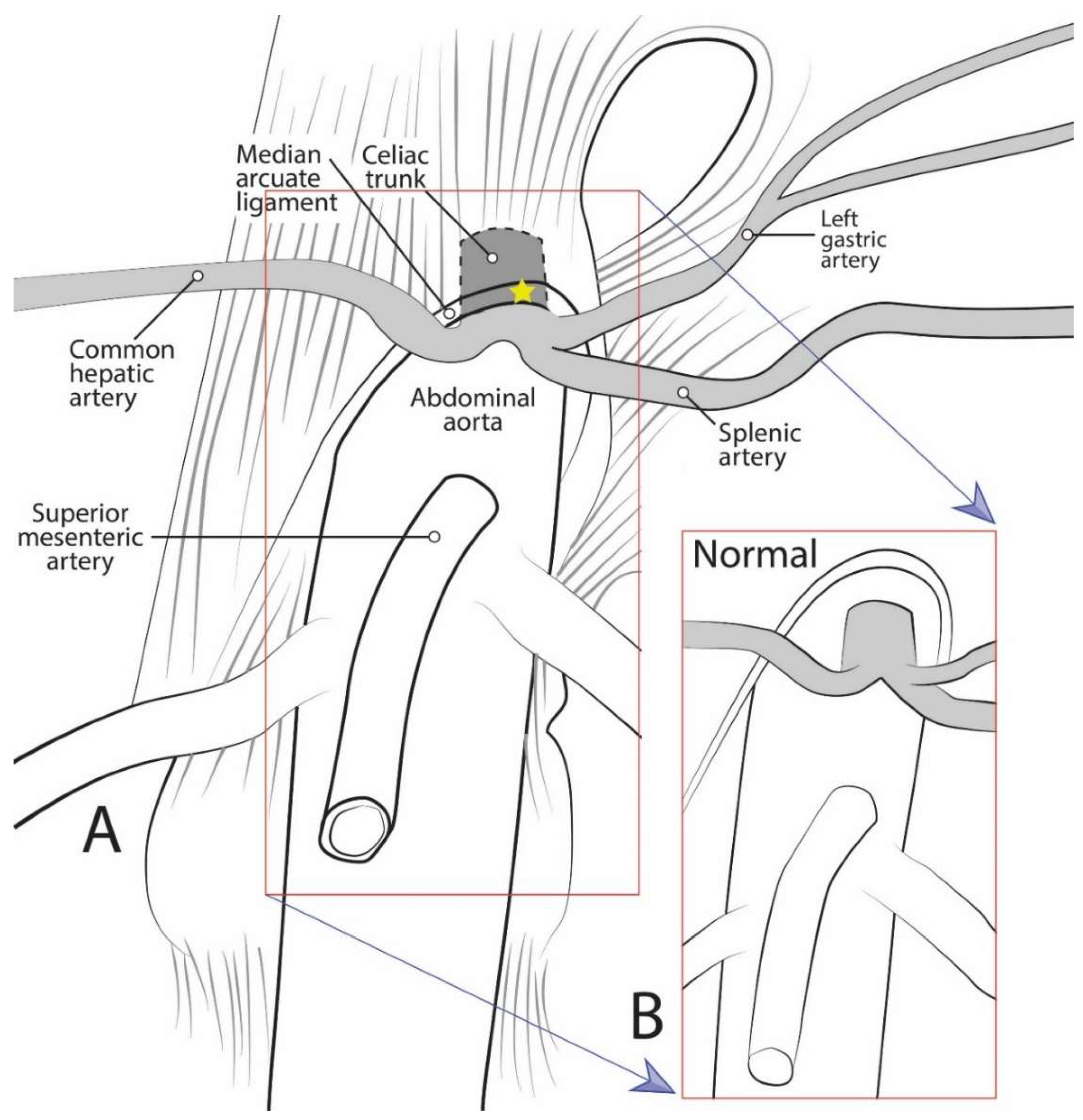 Celiac Trunk Abdominal Aorta Branches