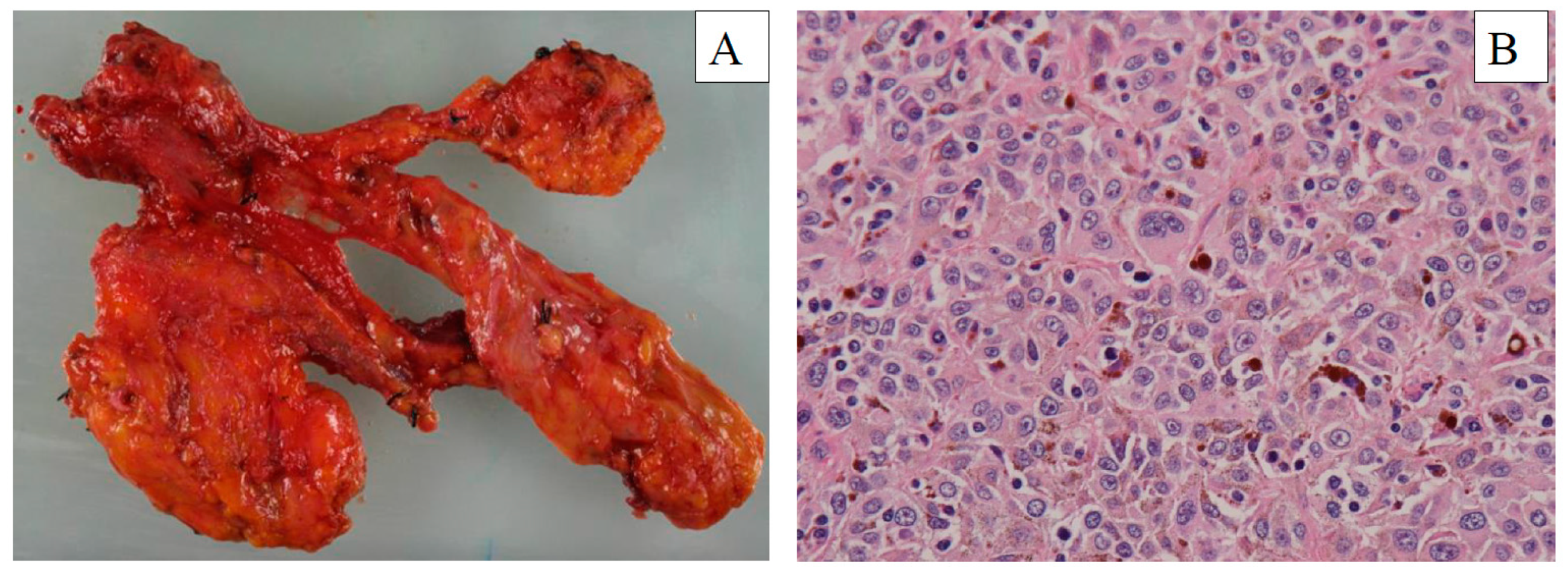 Diagnostics 10 00082 g004 Diagnostics 10 00082 g004