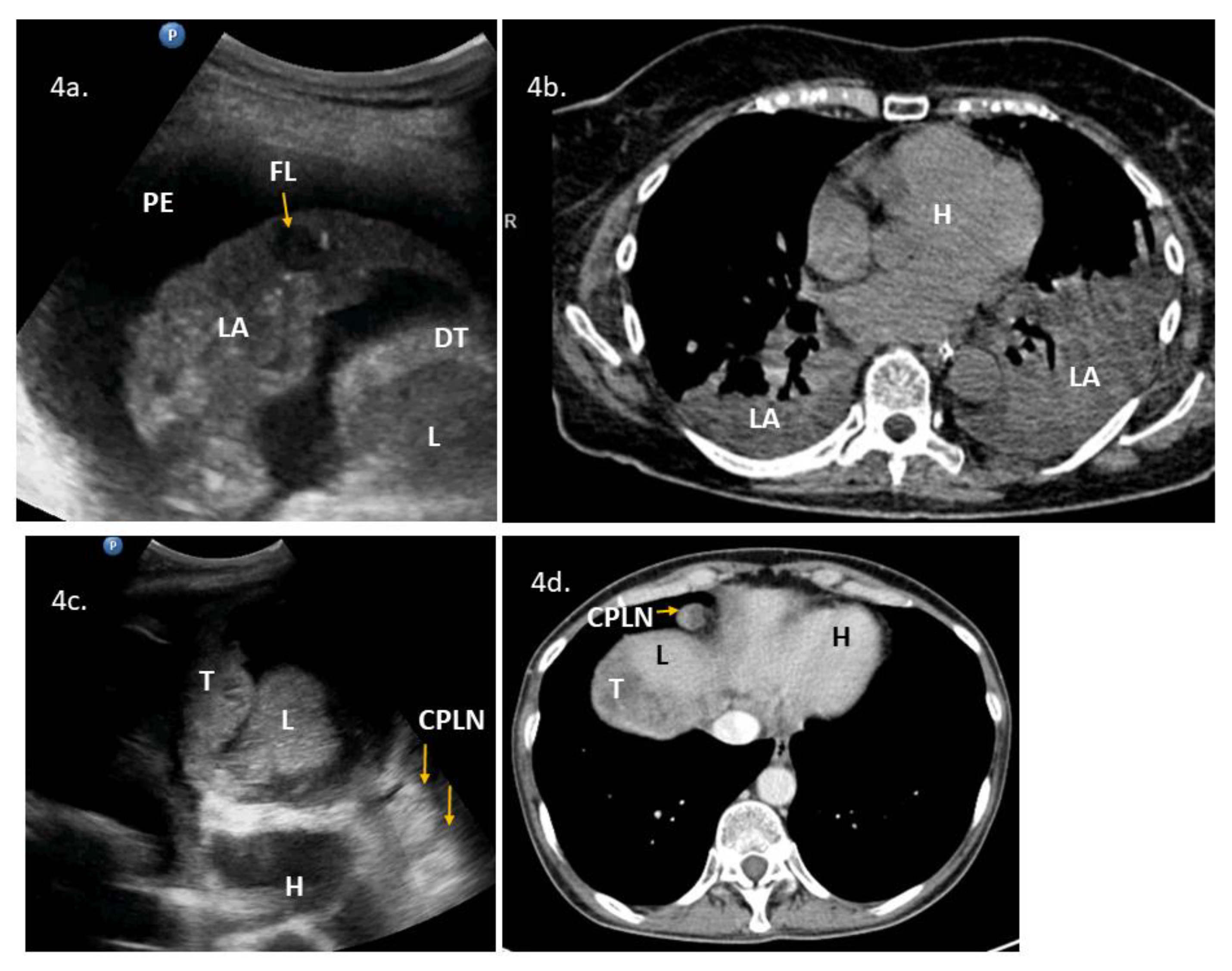 Diagnostics 10 00085 g004