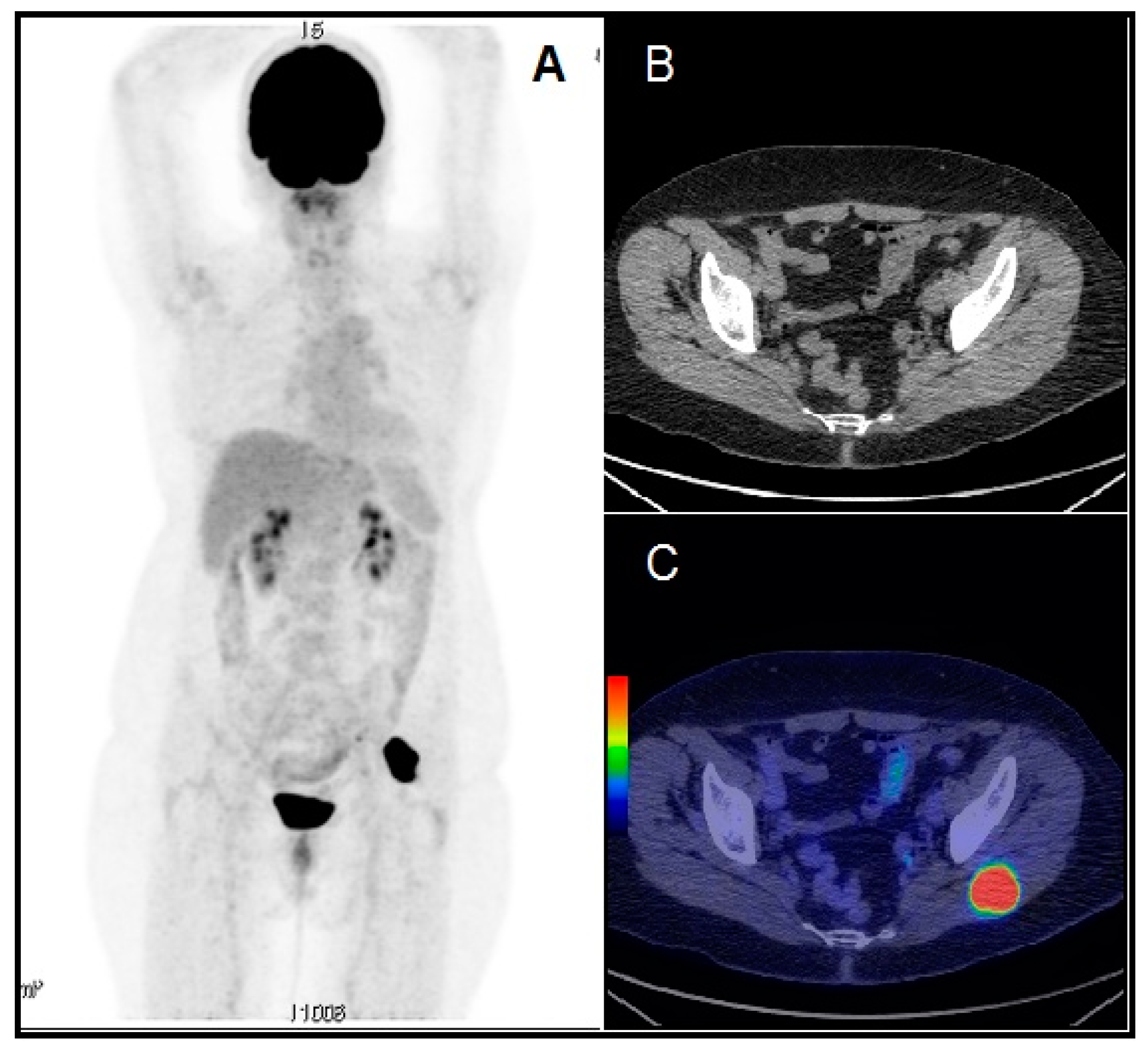 Diagnostics 10 00100 g005 Diagnostics 10 00100 g005
