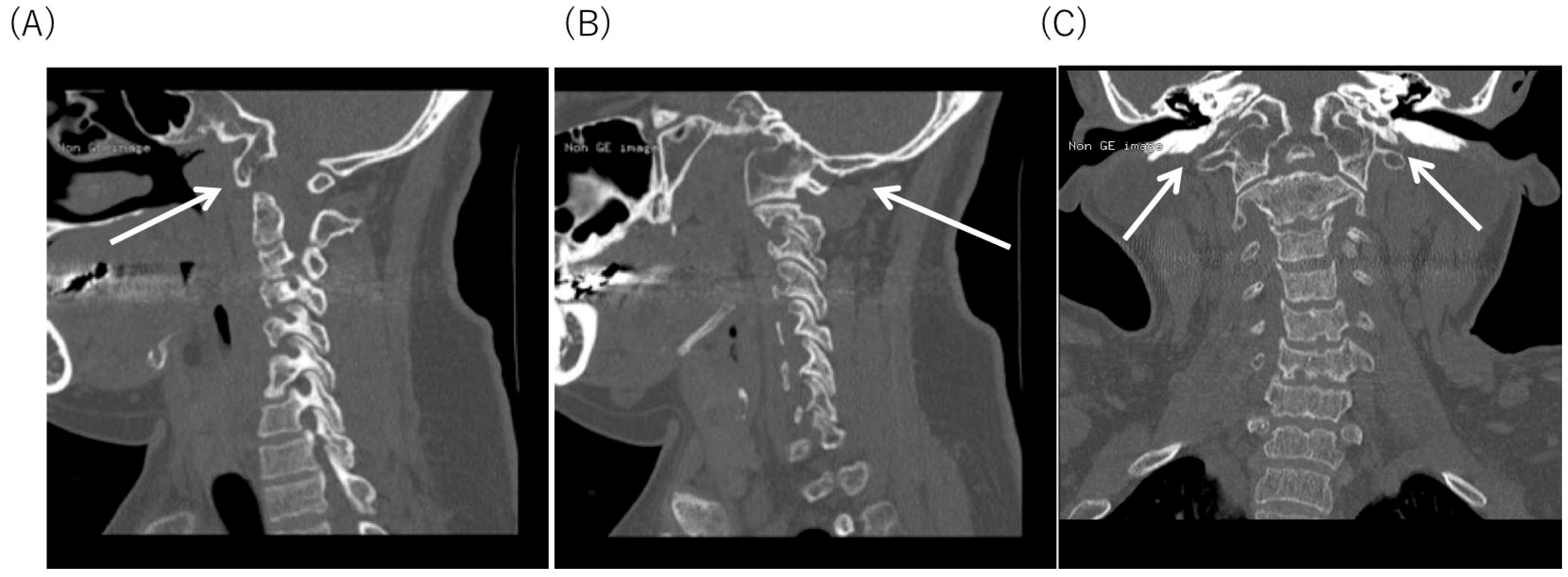 Diagnostics 10 00105 g002 Diagnostics 10 00105 g002
