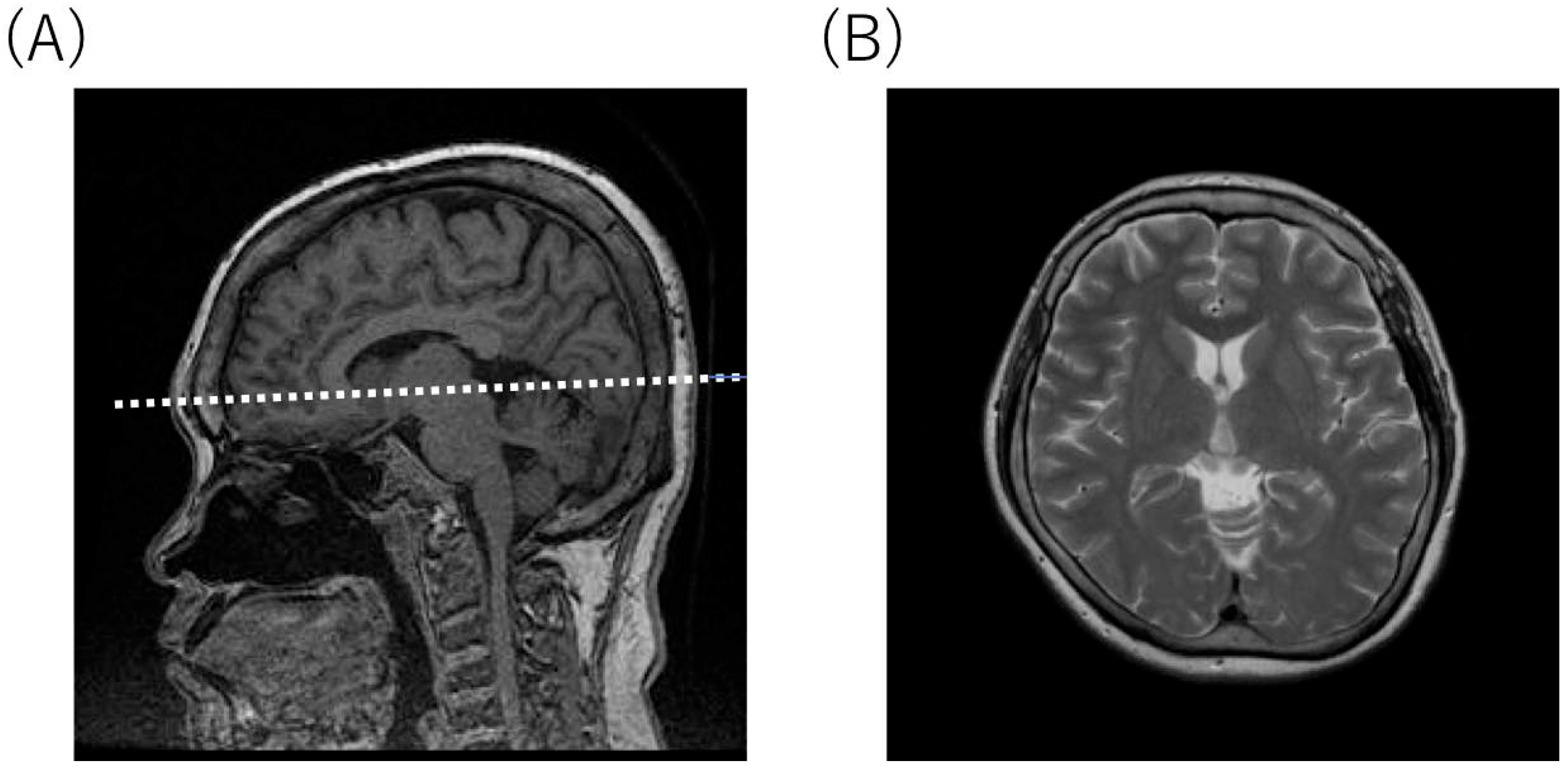 Diagnostics 10 00105 g003 Diagnostics 10 00105 g003