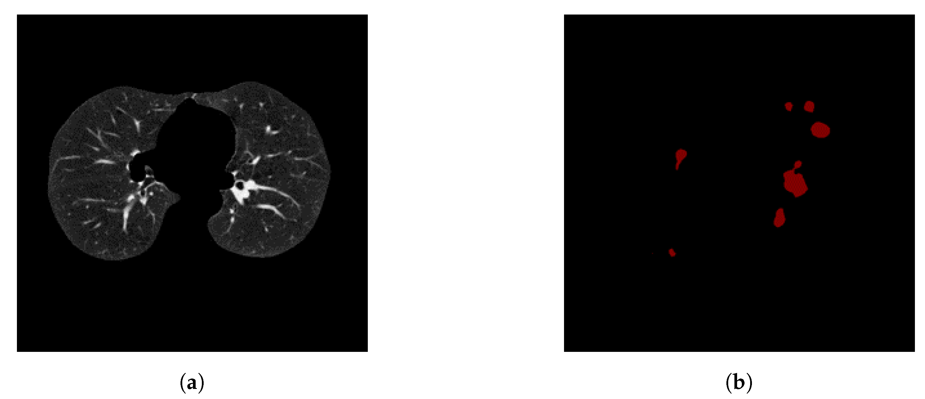 Diagnostics 10 00131 g009