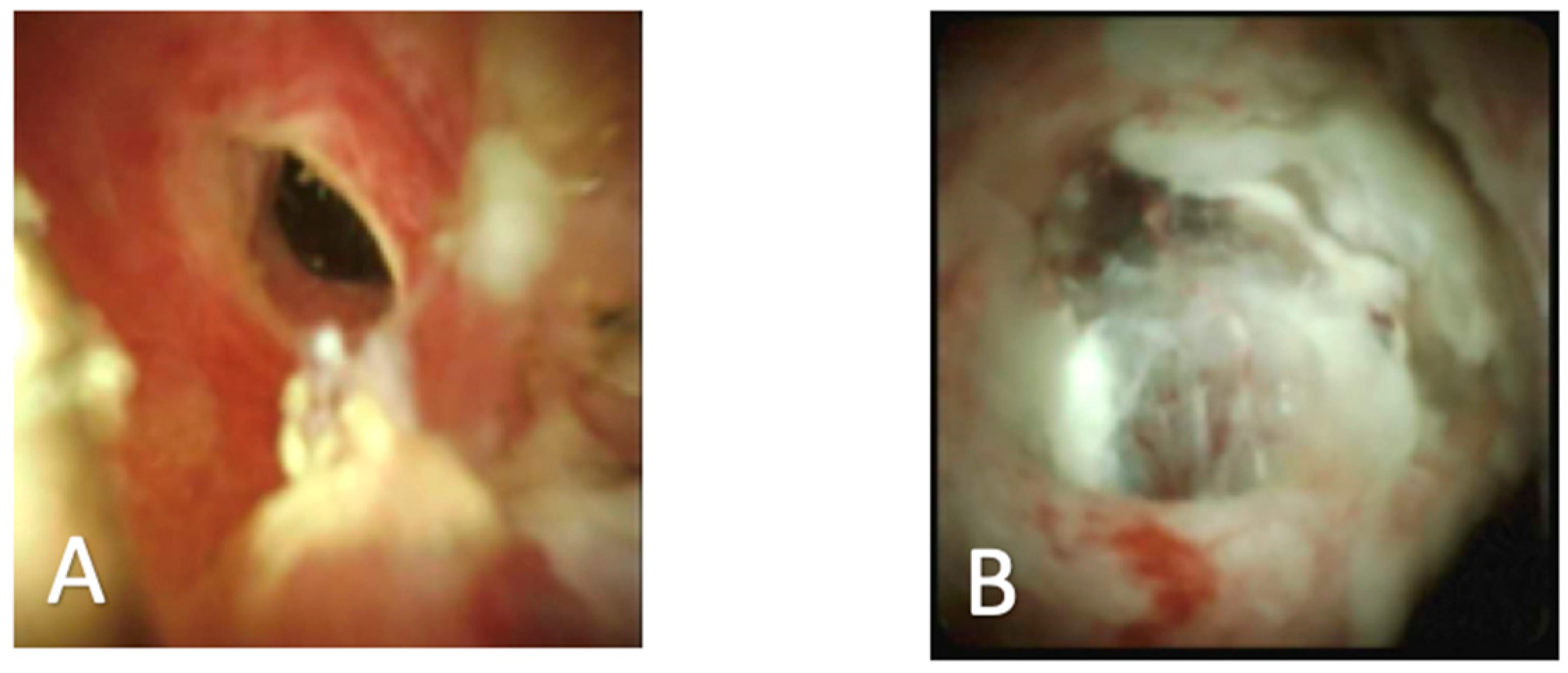 Diagnostics 10 00132 g002 Diagnostics 10 00132 g002