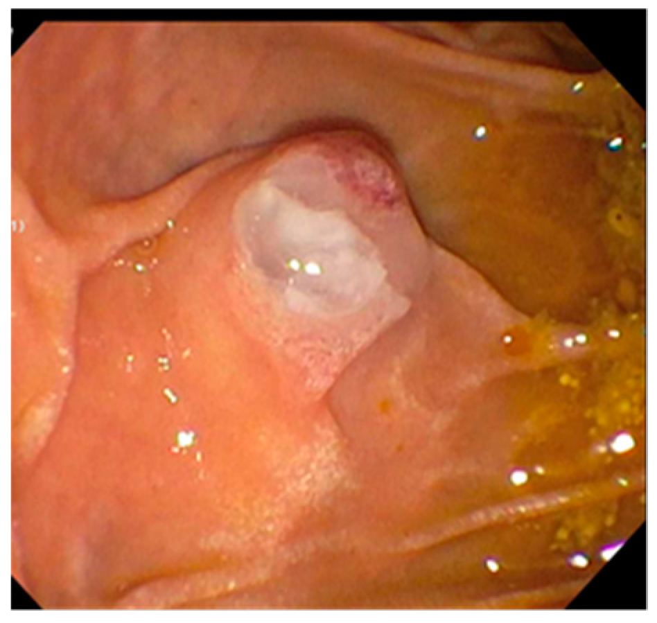 Diagnostics 10 00132 g003 Diagnostics 10 00132 g003