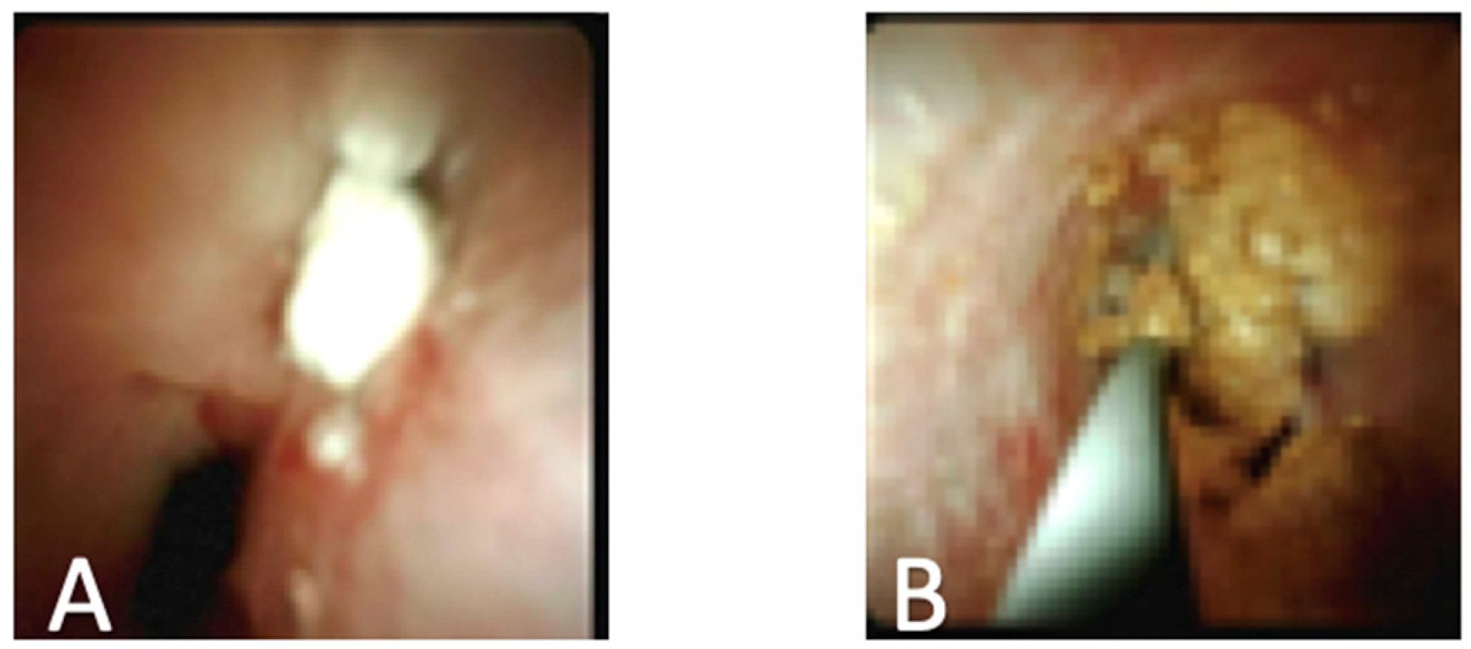 Diagnostics 10 00132 g004 Diagnostics 10 00132 g004