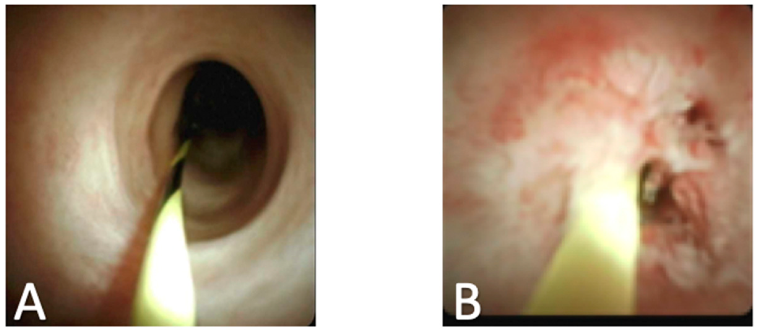 Diagnostics 10 00132 g005 Diagnostics 10 00132 g005