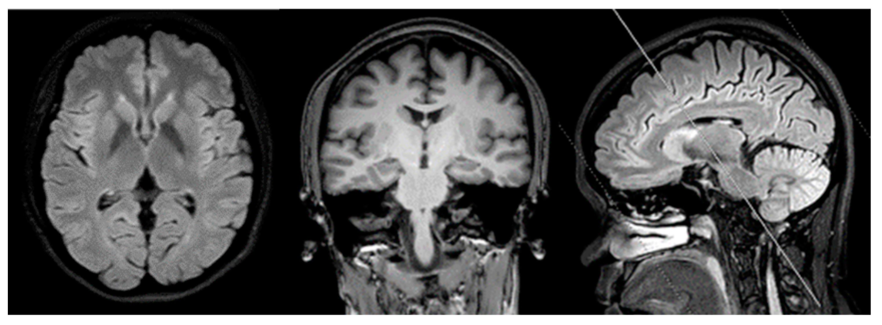 Diagnostics 10 00135 g001 Diagnostics 10 00135 g001