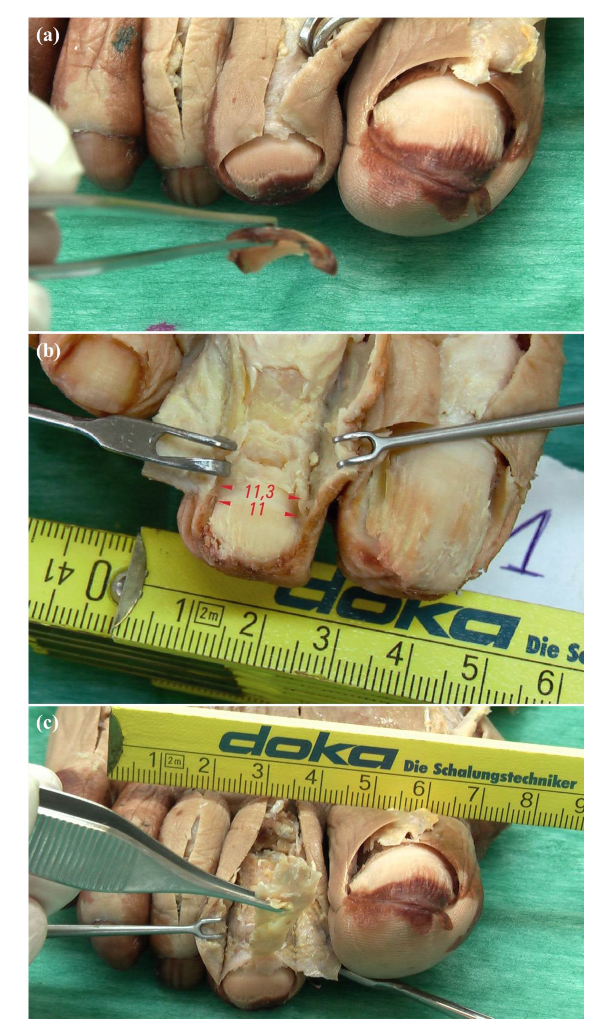 Diagnostics 10 00147 g001 Diagnostics 10 00147 g001