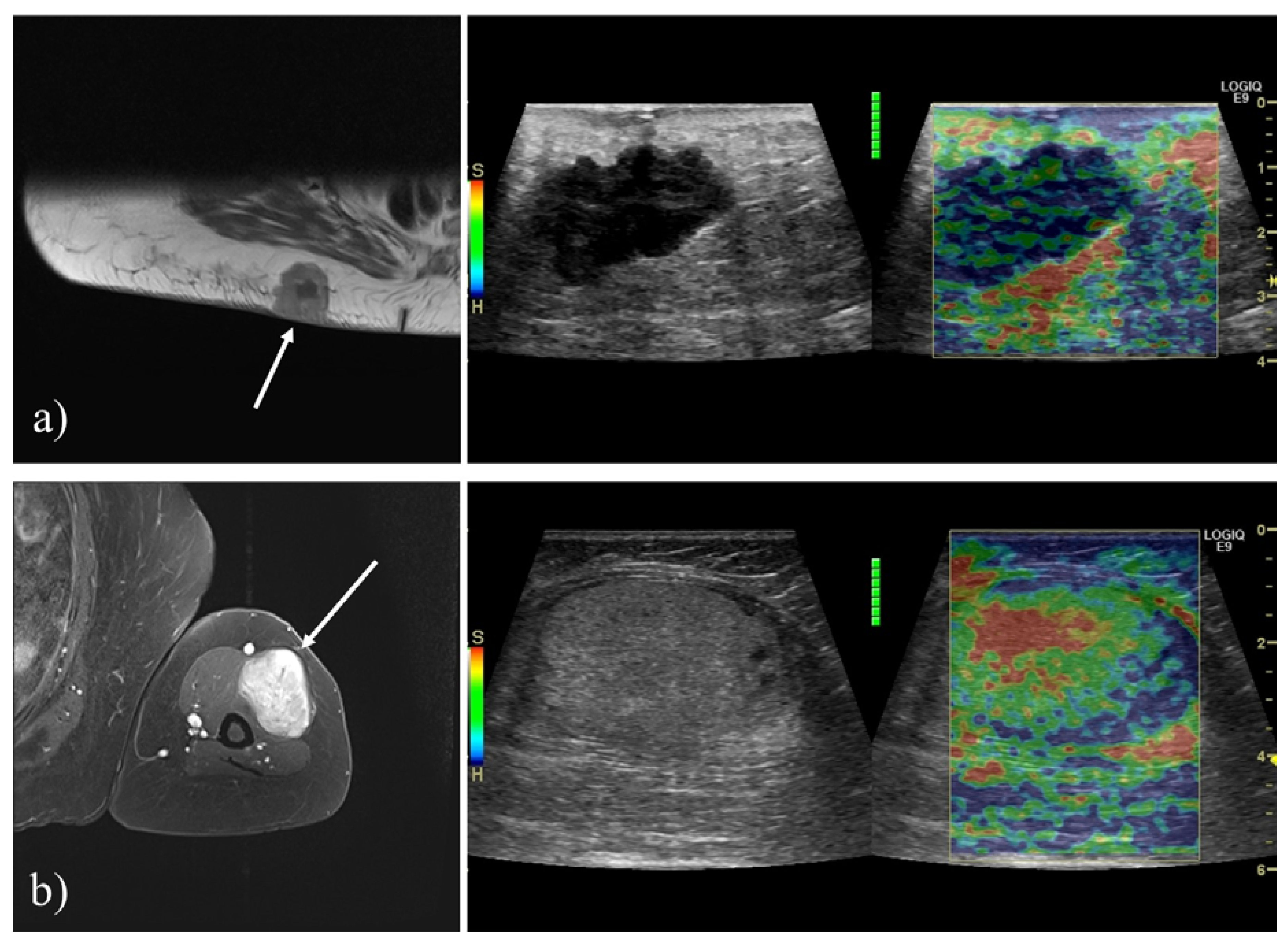 Diagnostics 10 00148 g002
